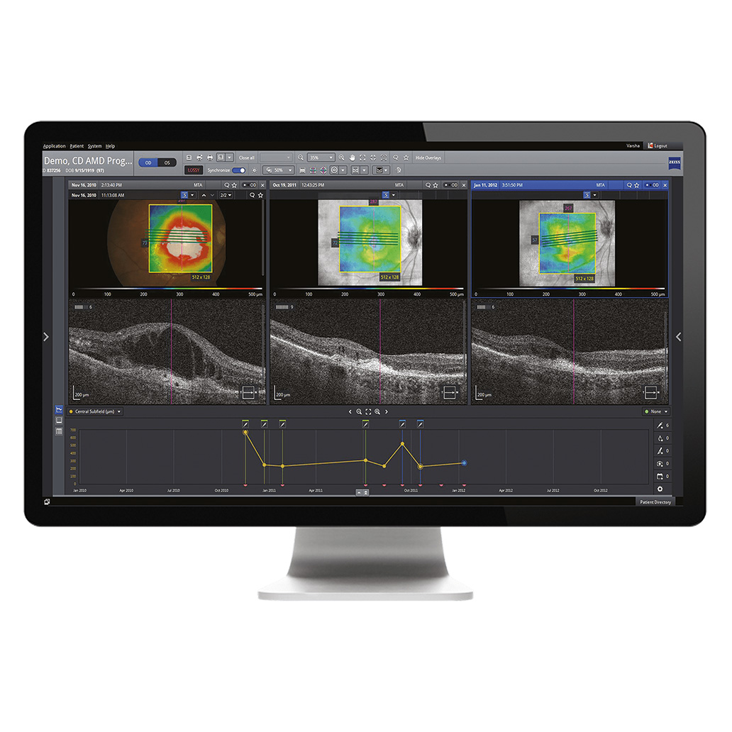 ZEISS Retina Integrating multi-modality data efficiently