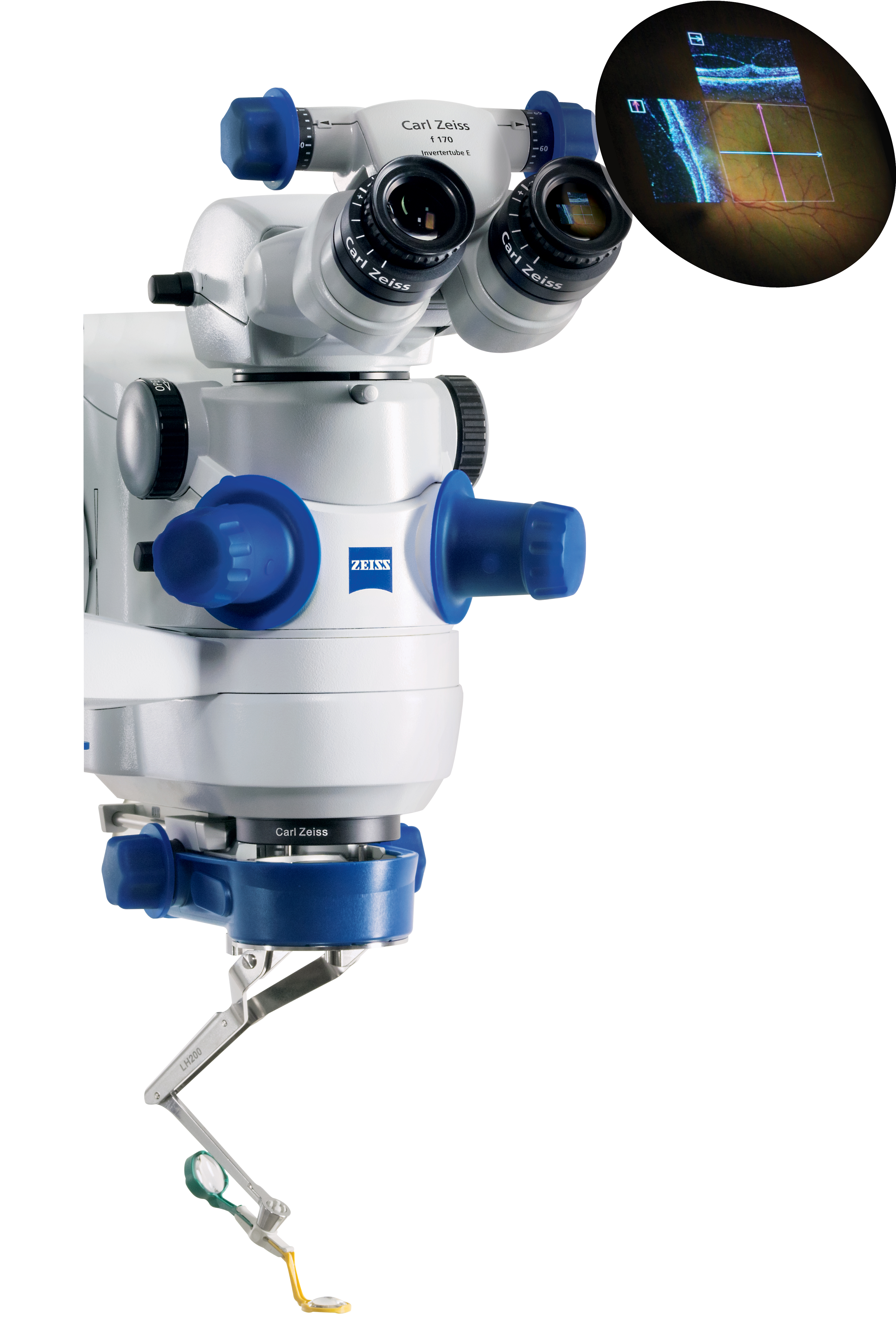 zeiss photos medical technology carl zeiss meditec ag