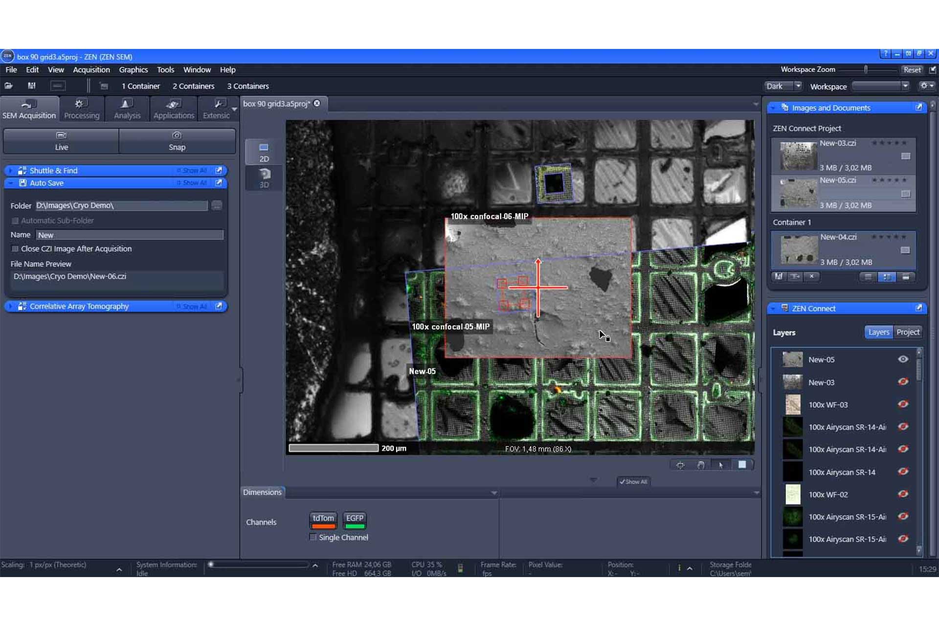 Korrelativer Kryo-Datensatz in ZEISS ZEN Connect