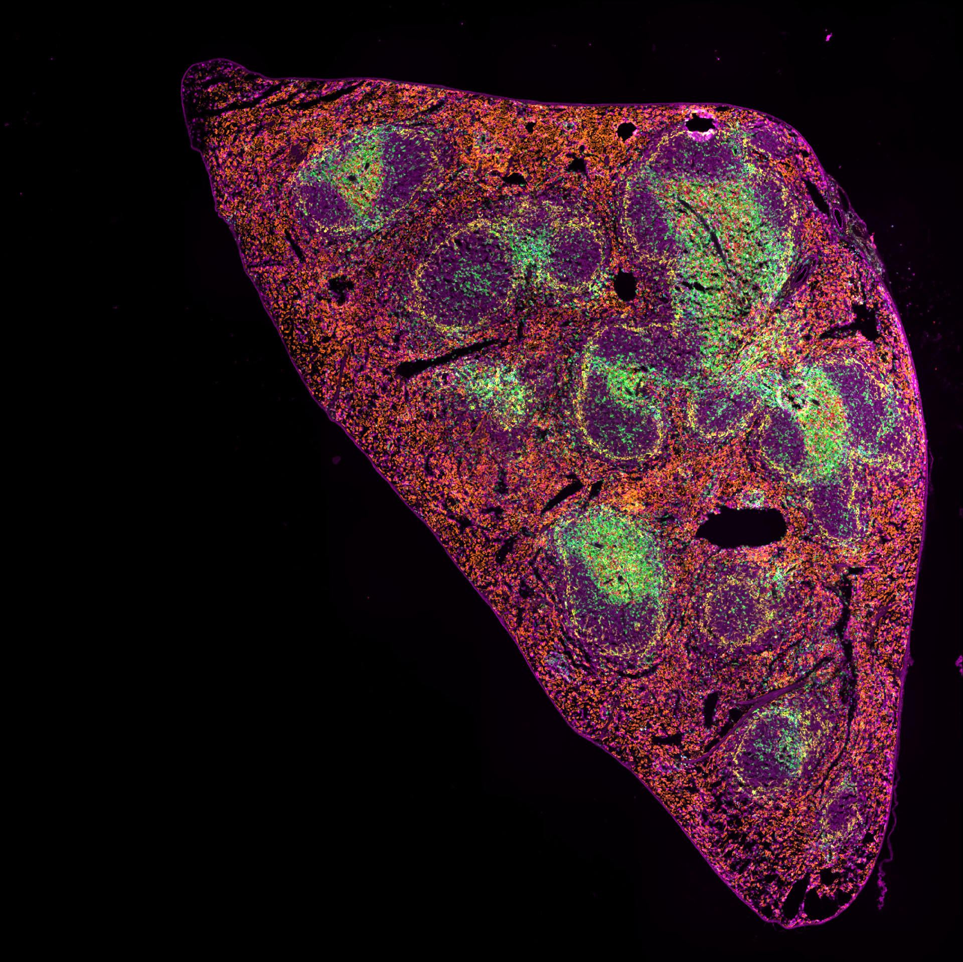5 μm FFPE section of mouse spleen simultaneously stained with 7 IF markers plus DAPI (not shown), imaged on ZEISS Axioscan 7 spatial biology