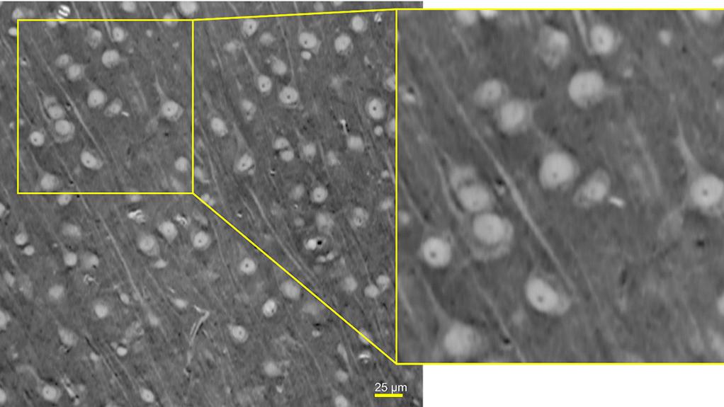 Soft tissue specimens like brain can be imaged using XRM to generate 3D structural maps that provide context for other investigative approaches, such as light microscopy or electron microscopy. The sample is a single slice from a 3D dataset of a mouse brain imaged with the 40X-P objective of the ZEISS Xradia Versa 630 XRM and reconstructed using ZEISS DeepRecon. An inverted LUT has been applied. Sample courtesy of Dr Kevin Boergens, University of Illinois at Chicago, USA.