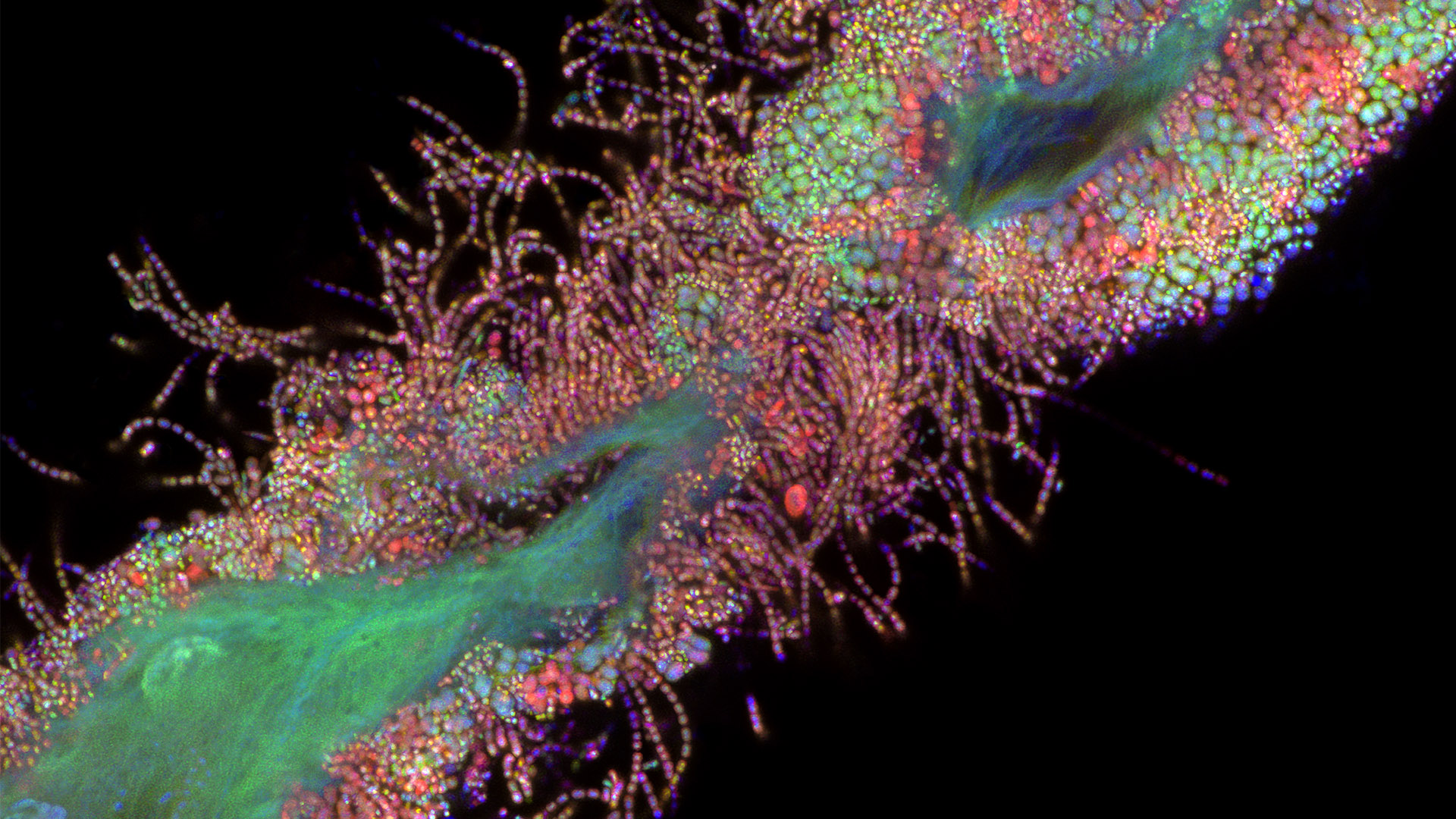 Winning image in the category of Life Sciences: "Bacteria bound to epithelial cells of the human tongue", acquired with ZEISS LSM 900 with Airyscan. Courtesy: T. deCarvalho, University of Maryland, Baltimore, USA