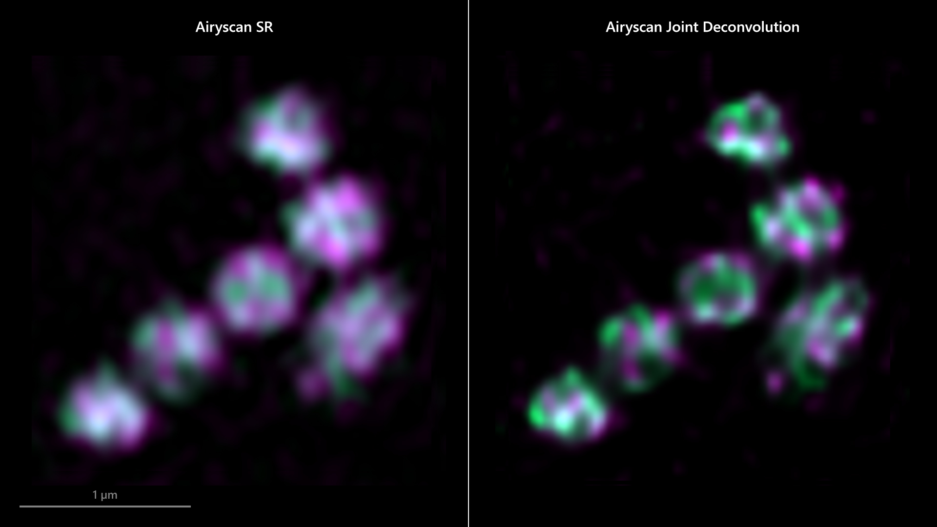 Die Mitochondrien in einer Arabidopsis thaliana-Zelle. Der Vergleich von ZEISS Airyscan SR (links) und ZEISS Airyscan Joint Deconvolution (rechts) zeigt im rechten Bild eine deutliche Verbesserung von Auflösung und Kanaltrennung. Mit freundlicher Genehmigung von J.-O. Niemeier, AG Schwarzländer, WWU Münster, Deutschland