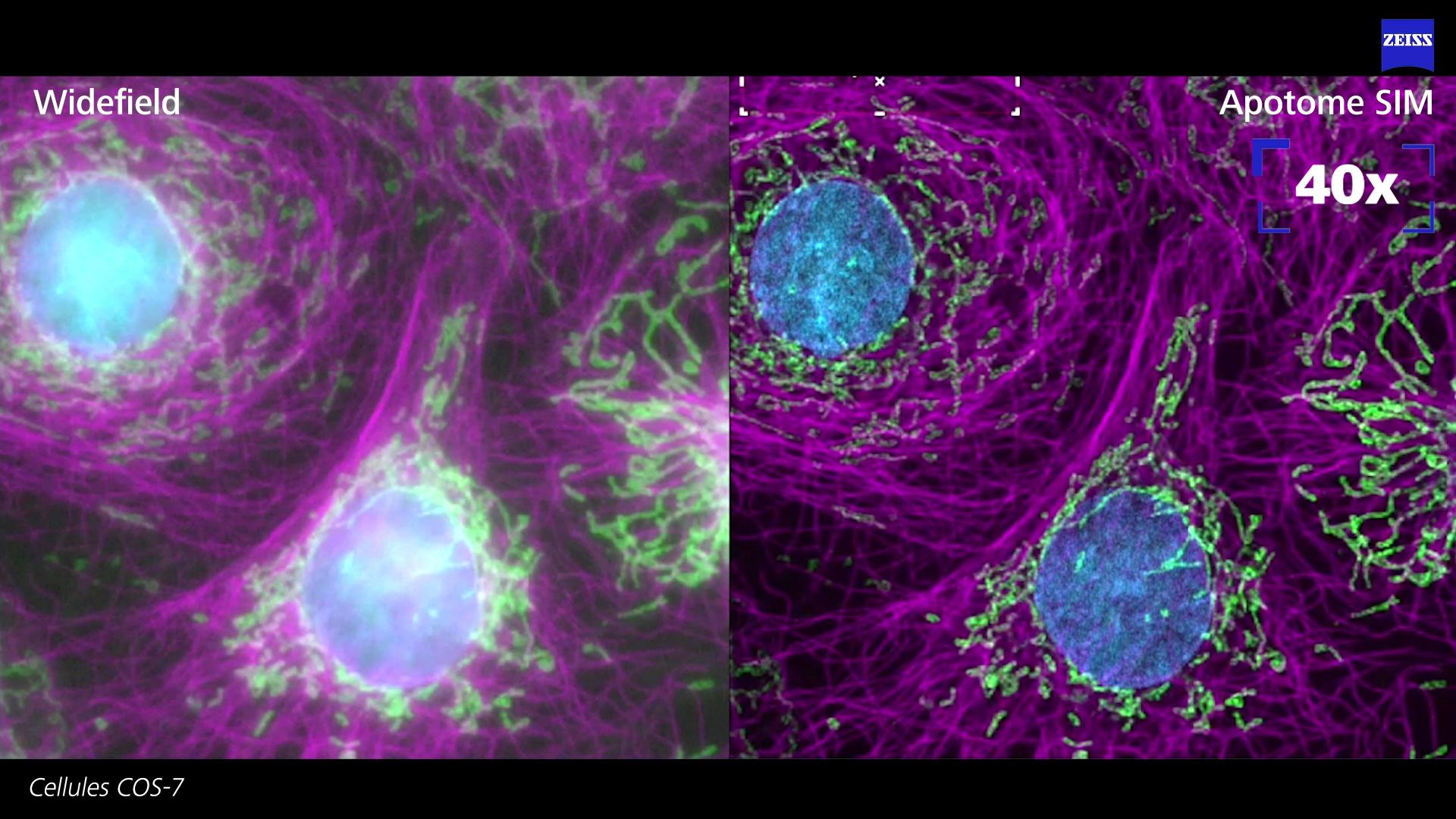 Microscopie super-résolution : Nouvelle famille Lattice SIM