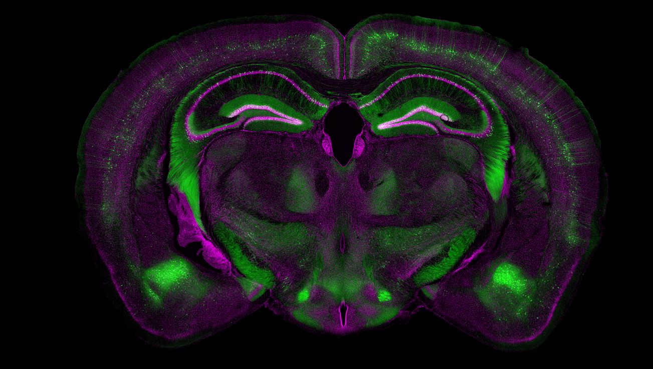 Mouse brain, ZEN Connect application example
