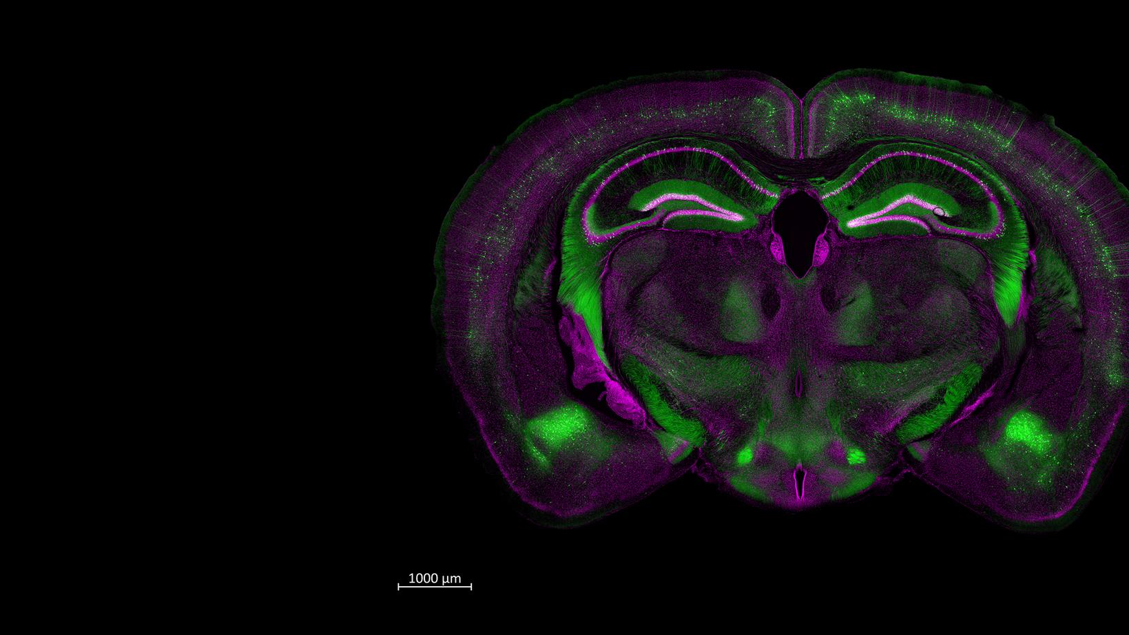 Mouse brain, ZEN Connect application example