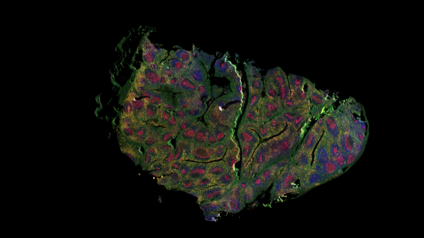 Human tonsil tissue stained with multiple cancer markers