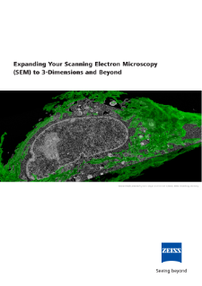 Preview image of Expanding Your Scanning Electron Microscopy to 3-Dimensions and Beyond