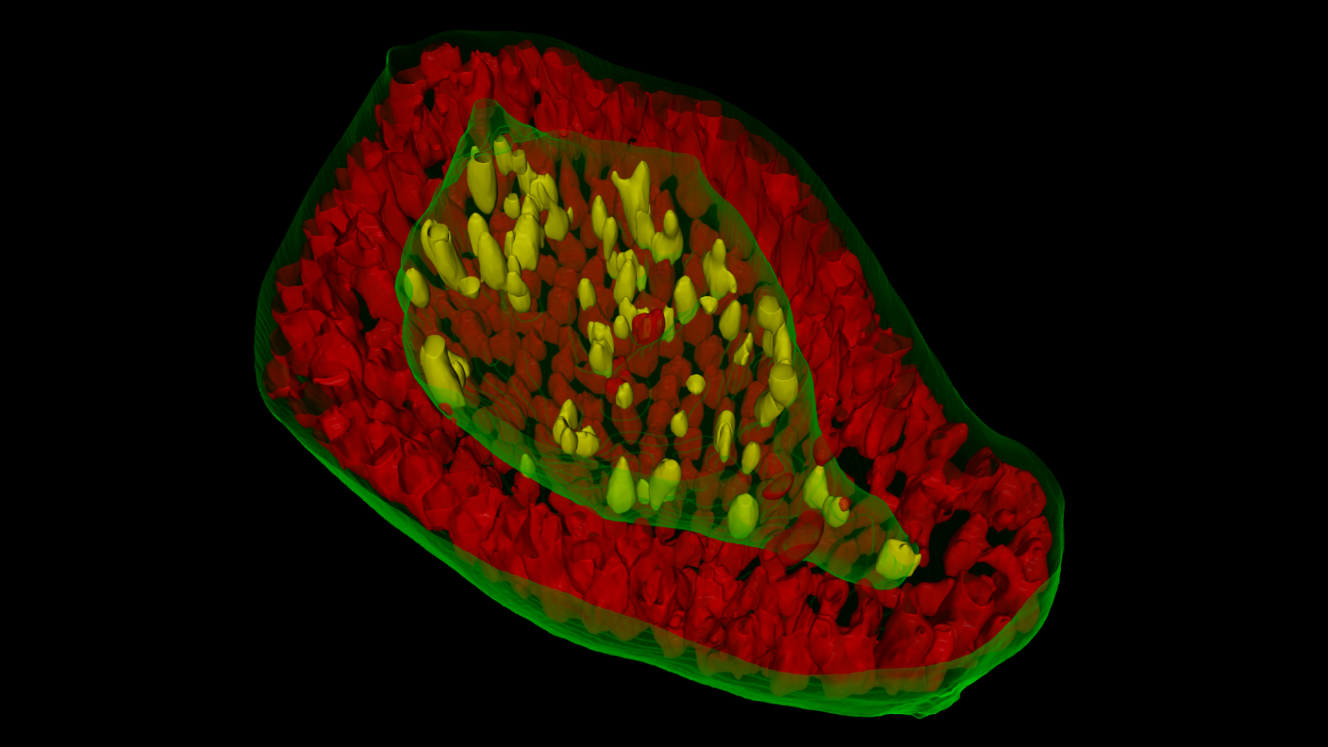 3D Organoid, sub cellular structures (Epithelial Cell Layer and Inner Lumen).  Study the role of Wnt signaling in organoid formation. Acquired with ZEISS Celldiscoverer 7 Confocal scan with Airyscan.
