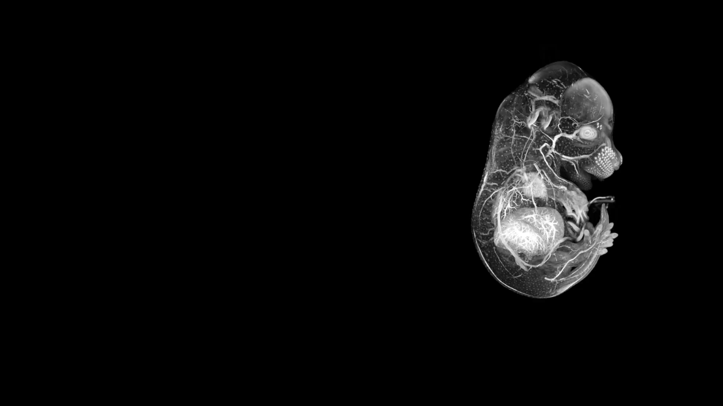3D reconstructed volume of a mouse embryo imaged with ZEISS Xradia Versa to show internal organs. Sample courtesy of Dr Zheng Zhifa, Beijing Union Medical College Hospitals.