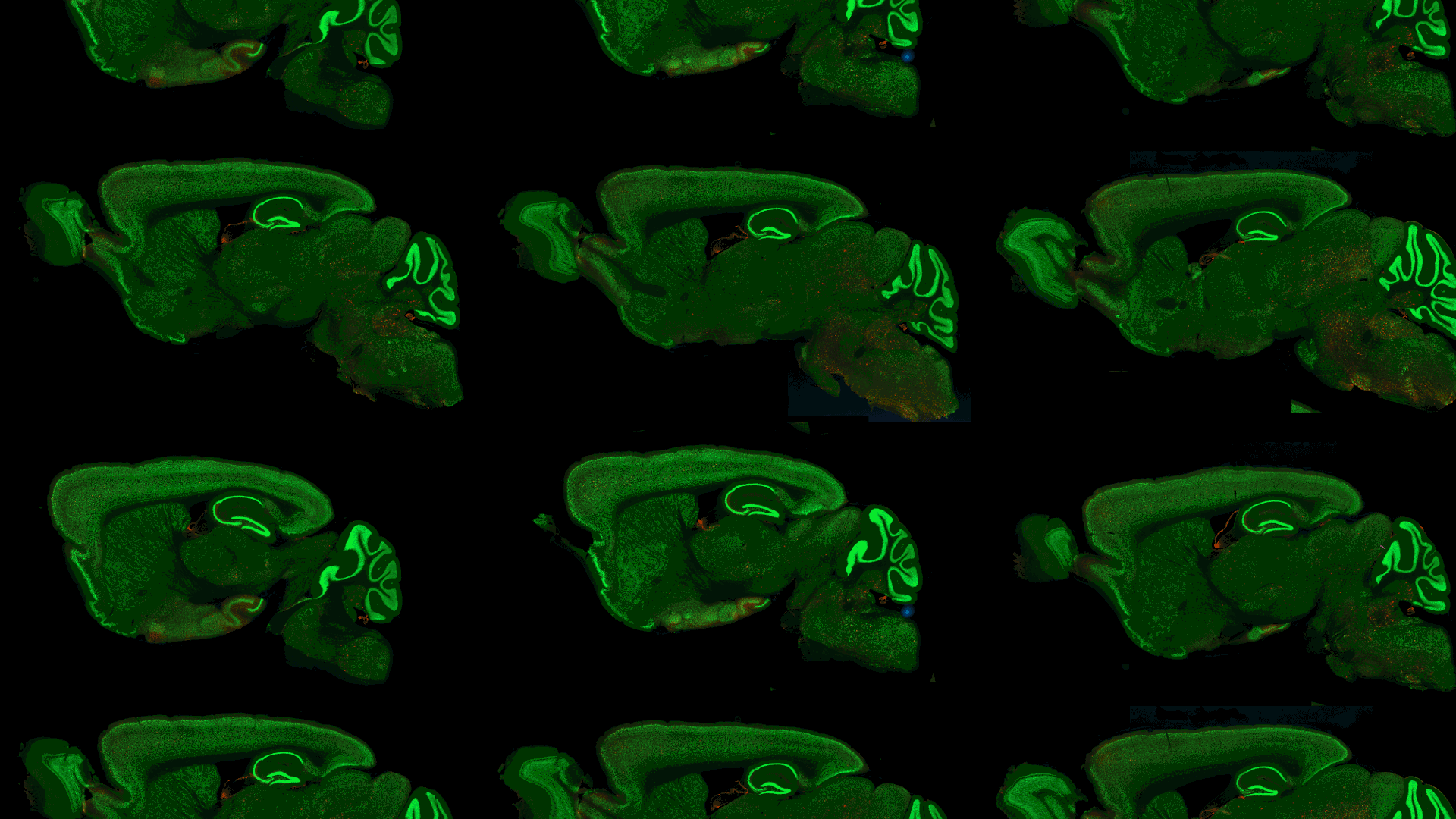 ZEISS neuroscience microscopy applications