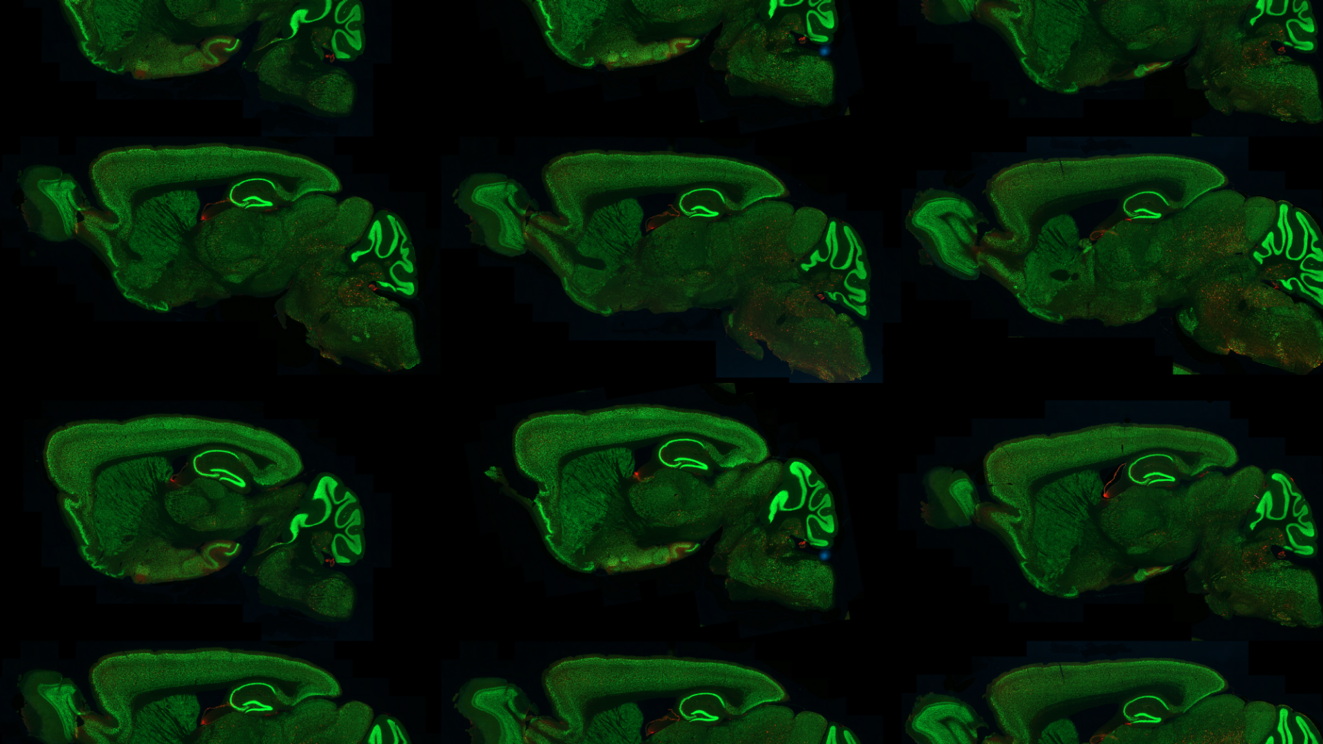 ZEISS neuroscience microscopy applications