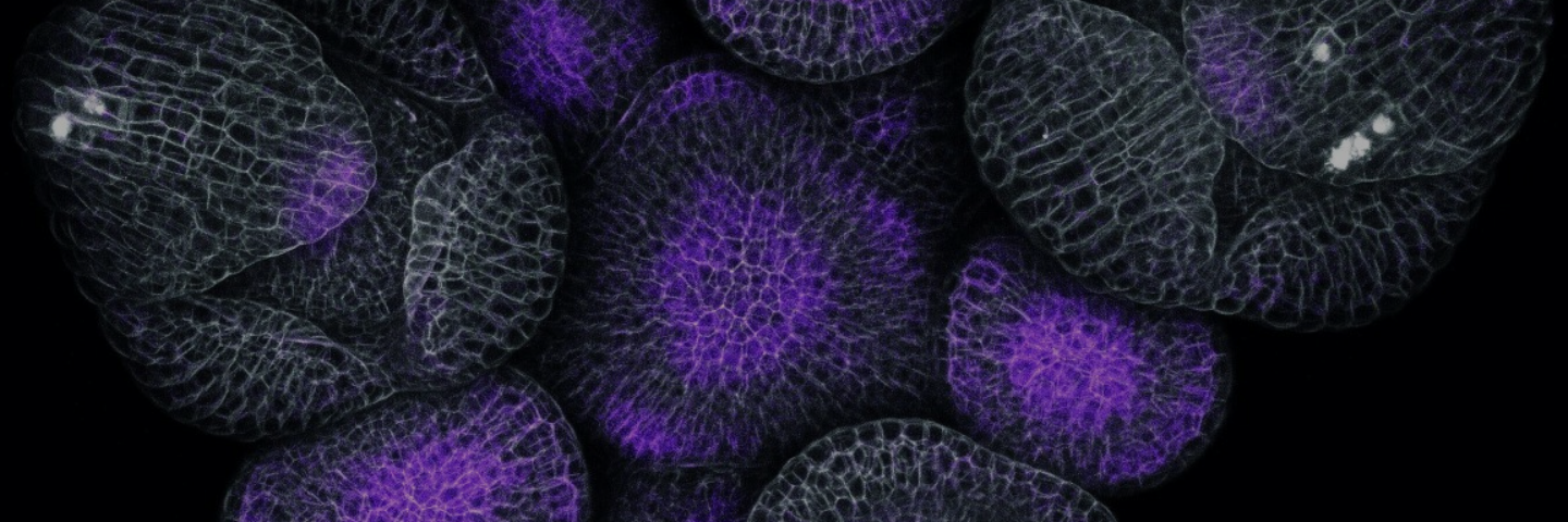 Inflorescence of Arabidopsis thaliana