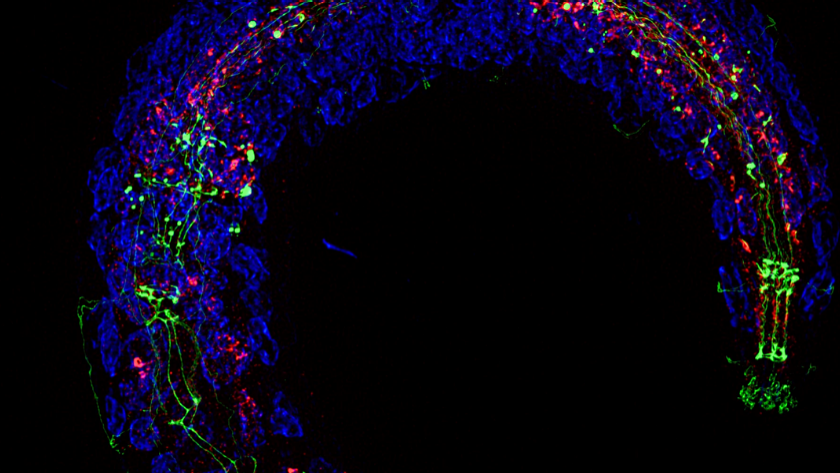 C. Elegan model organisms