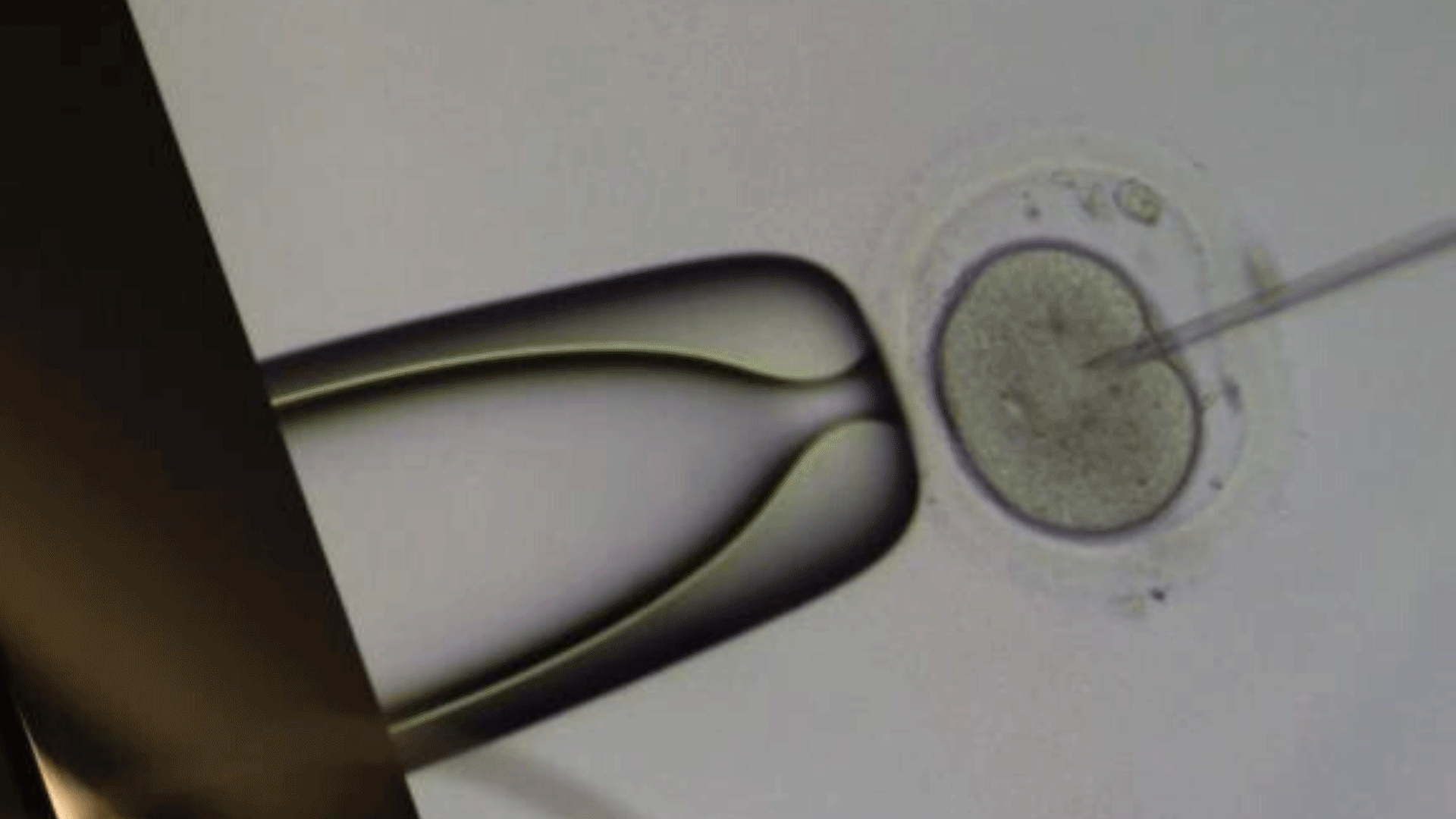 in-vitro-grid-axio-observer.