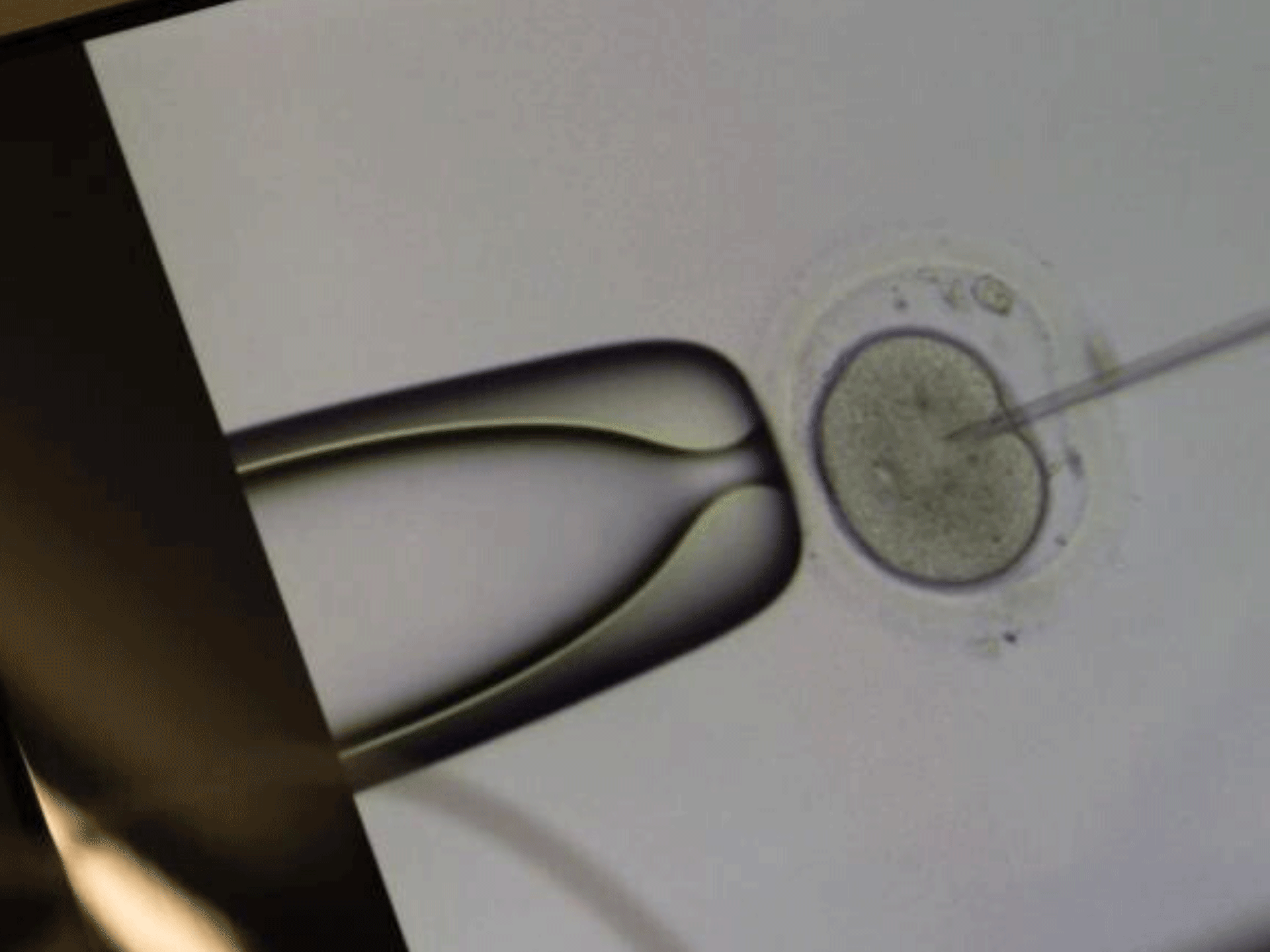 Fertilization, assisted reproductive technology, ICSI, oocyte, Axio Observer, Narishige micromanipulation