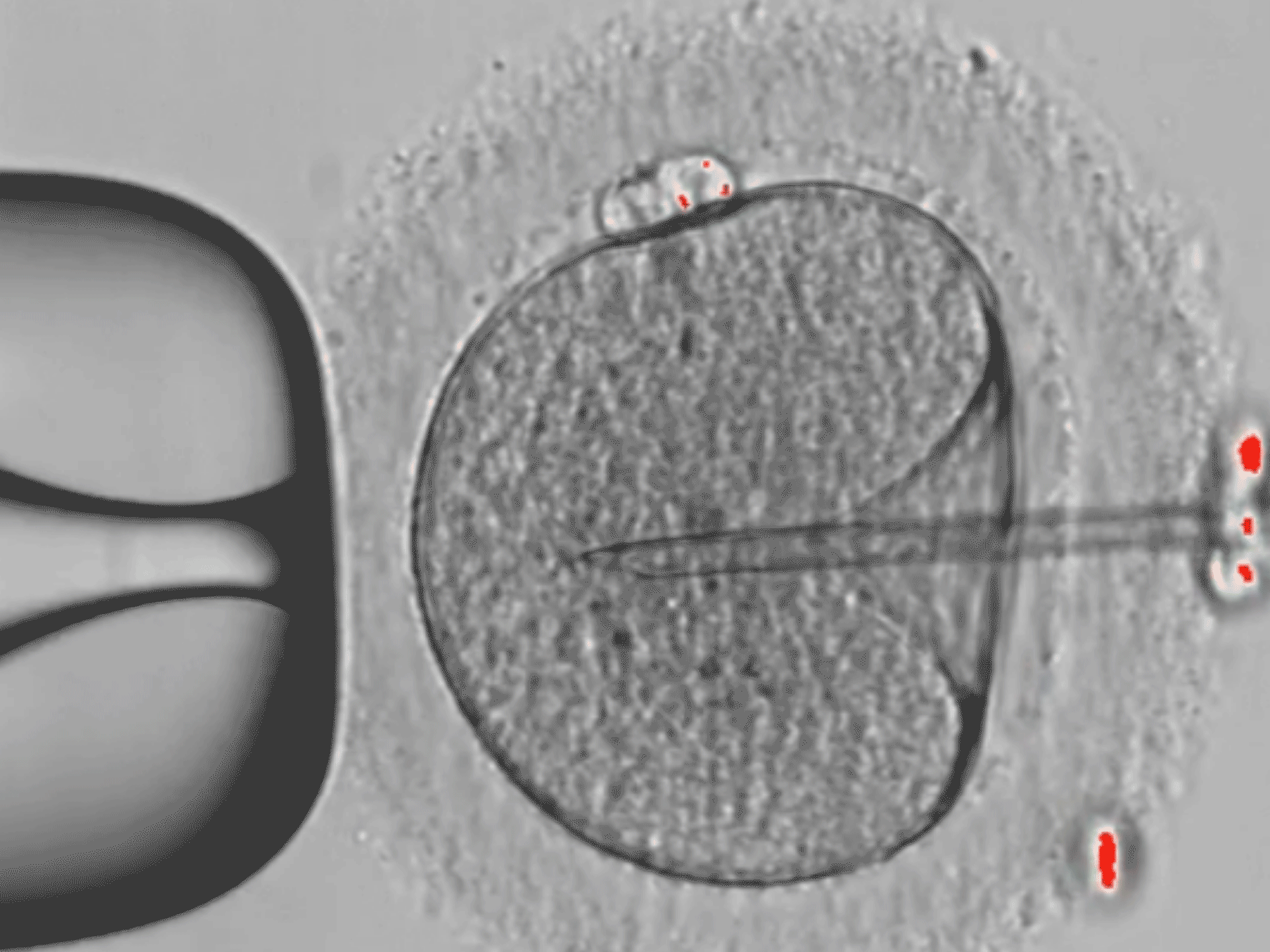  Assisted Reproductive technologies (APAC)