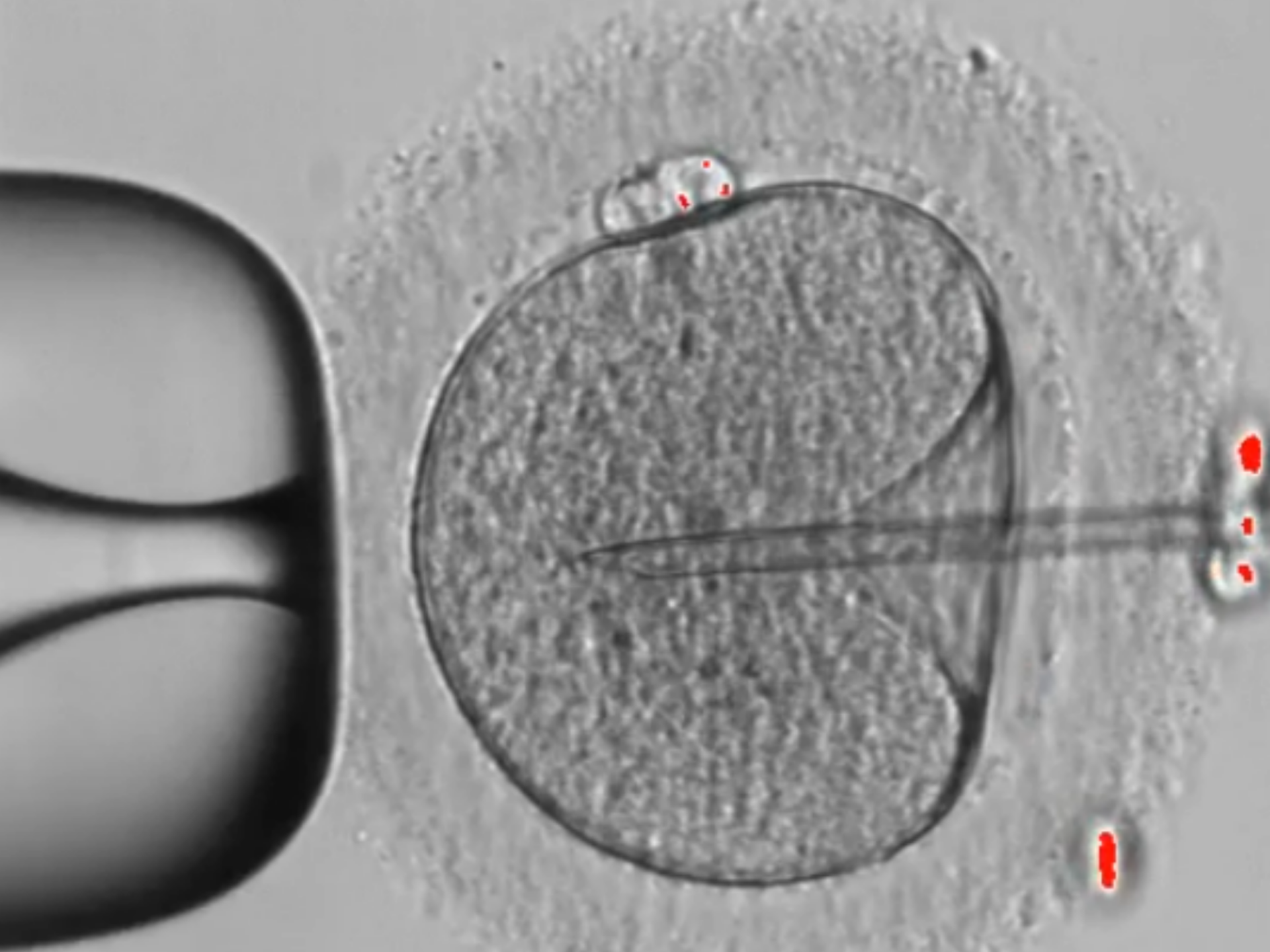  Assisted Reproductive technologies (APAC)