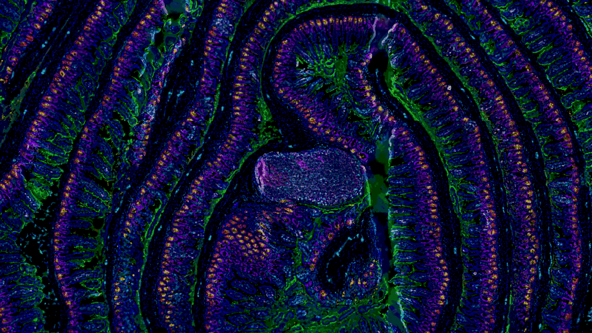 5 µm section of a formalin fixed paraffin-embedded mouse small intestine swiss roll. Section was stained with a 14 CODEX antibody panel designed to visualize intestinal stem and enteroendocrine cells (Lysozyme in red, villin in green, MHCII in gray, vimentin in cyan, Ki67 in magenta, and Olfm4 in yellow). Blue signals correspond to DAPI nuclear staining. Acquisition was done with a ZEISS Axio Observer microscope and processing with the Akoya CODEX Processor. 