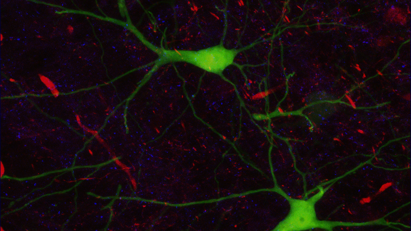 PJ118 mouse brain slice GFPThy1 Cy3 Calretin Cy5 GAD65_Sb50_c123