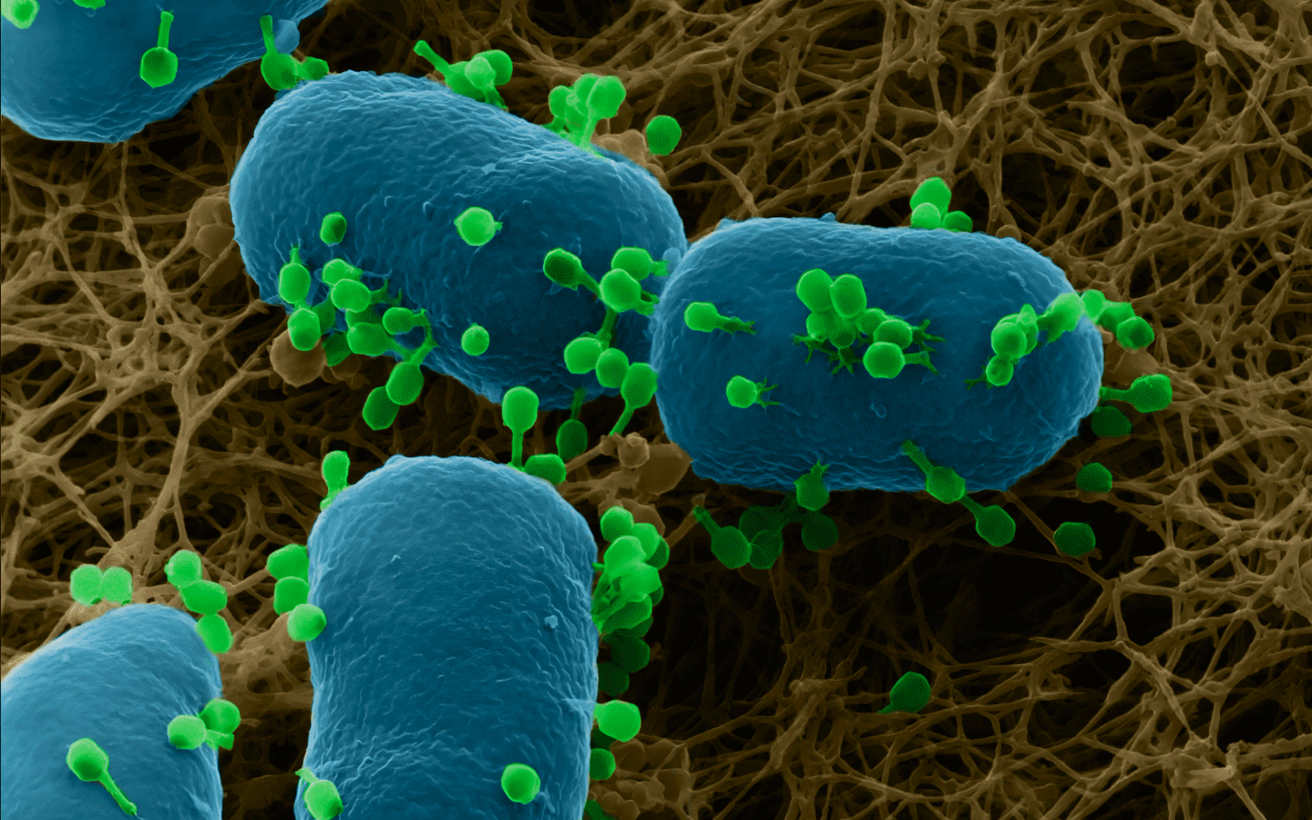 Microbiology & Microbial Research 