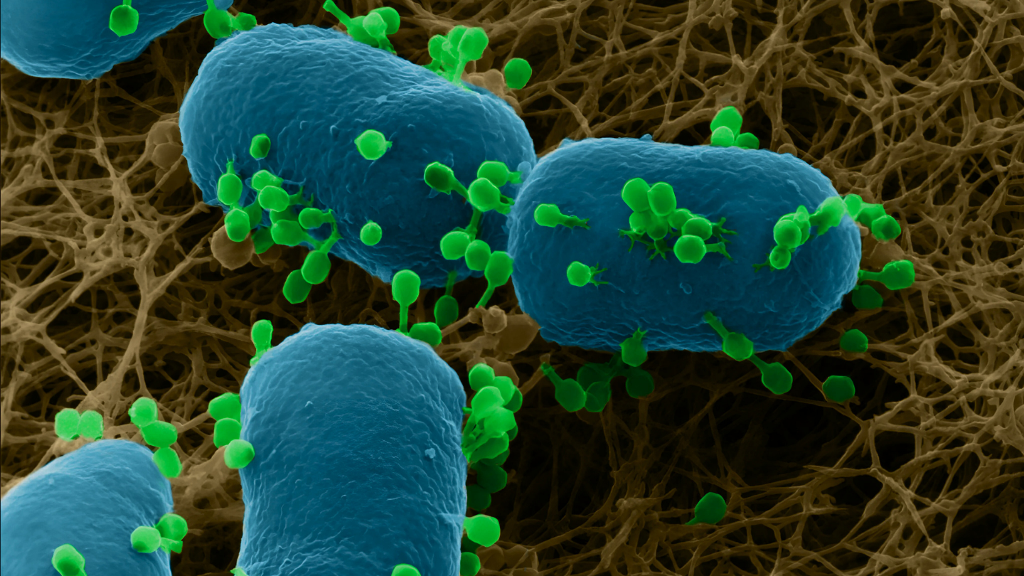 Study with this system offers great insights to interactions of the viruses with bacteria as it happens on the bacteria plate.