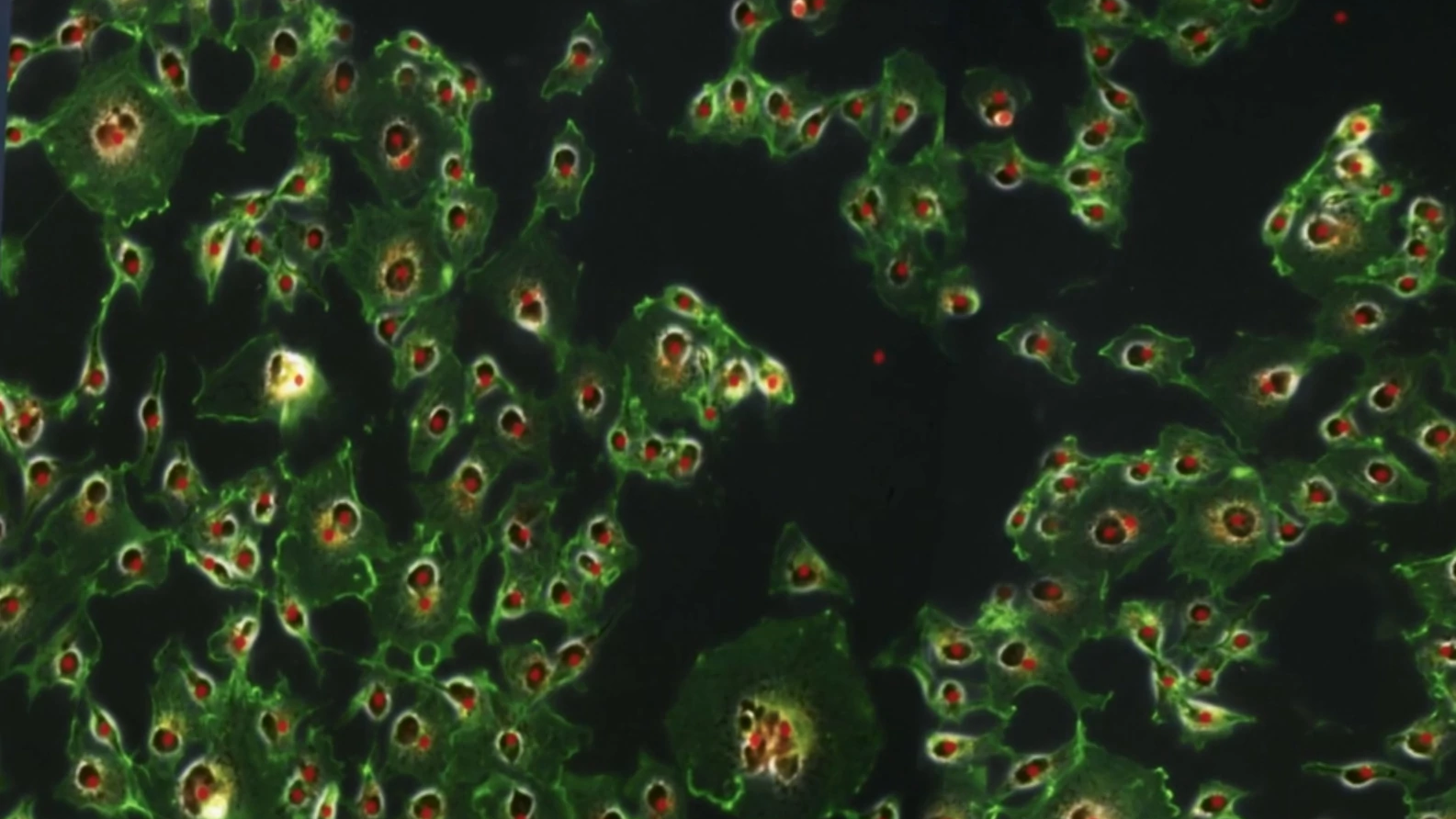 nuclei count with Labscope AI cell counting module
