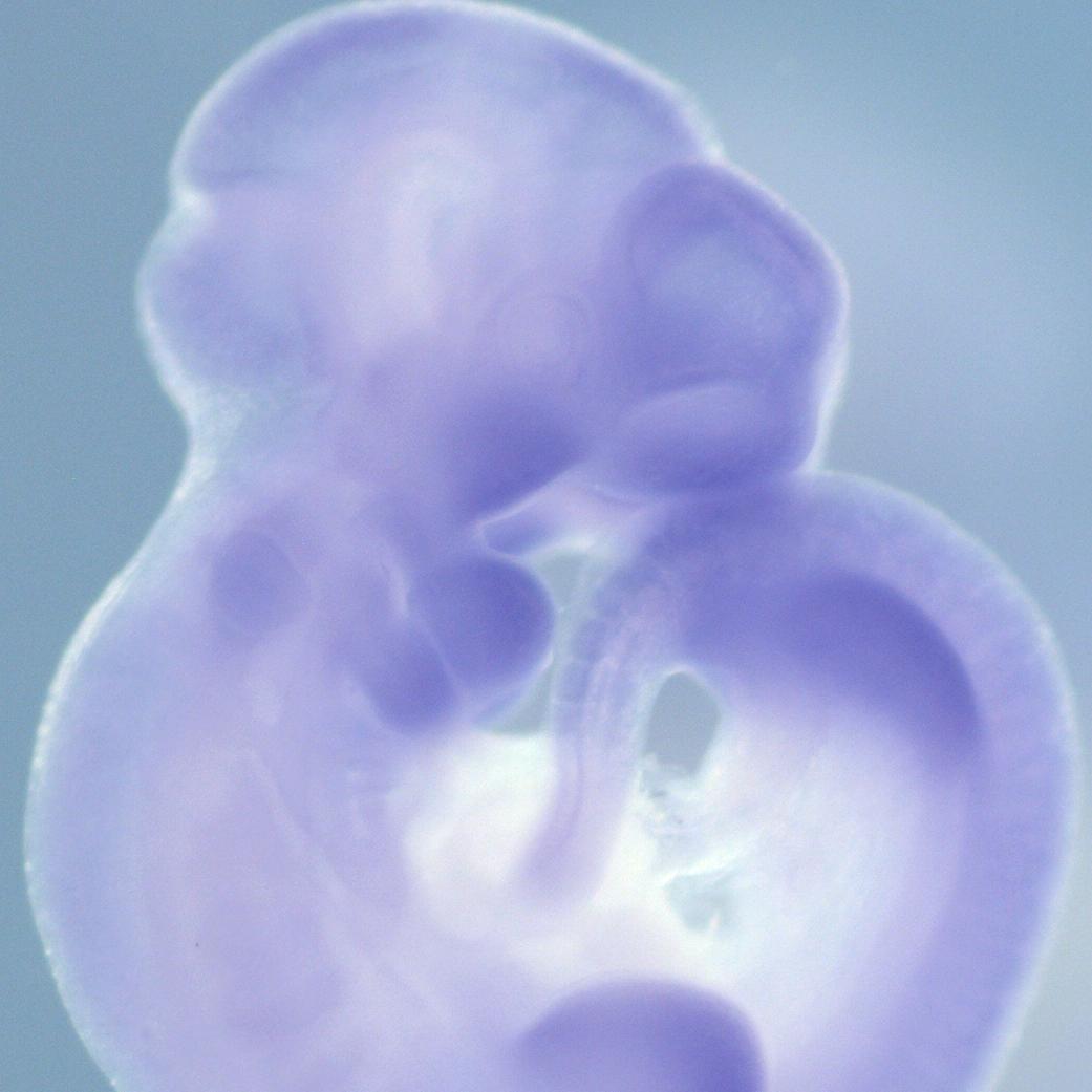 Imaged using ZEISS Stemi 508 stereo microscope.