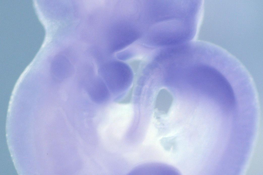 Imaged using ZEISS Stemi 508 stereo microscope.