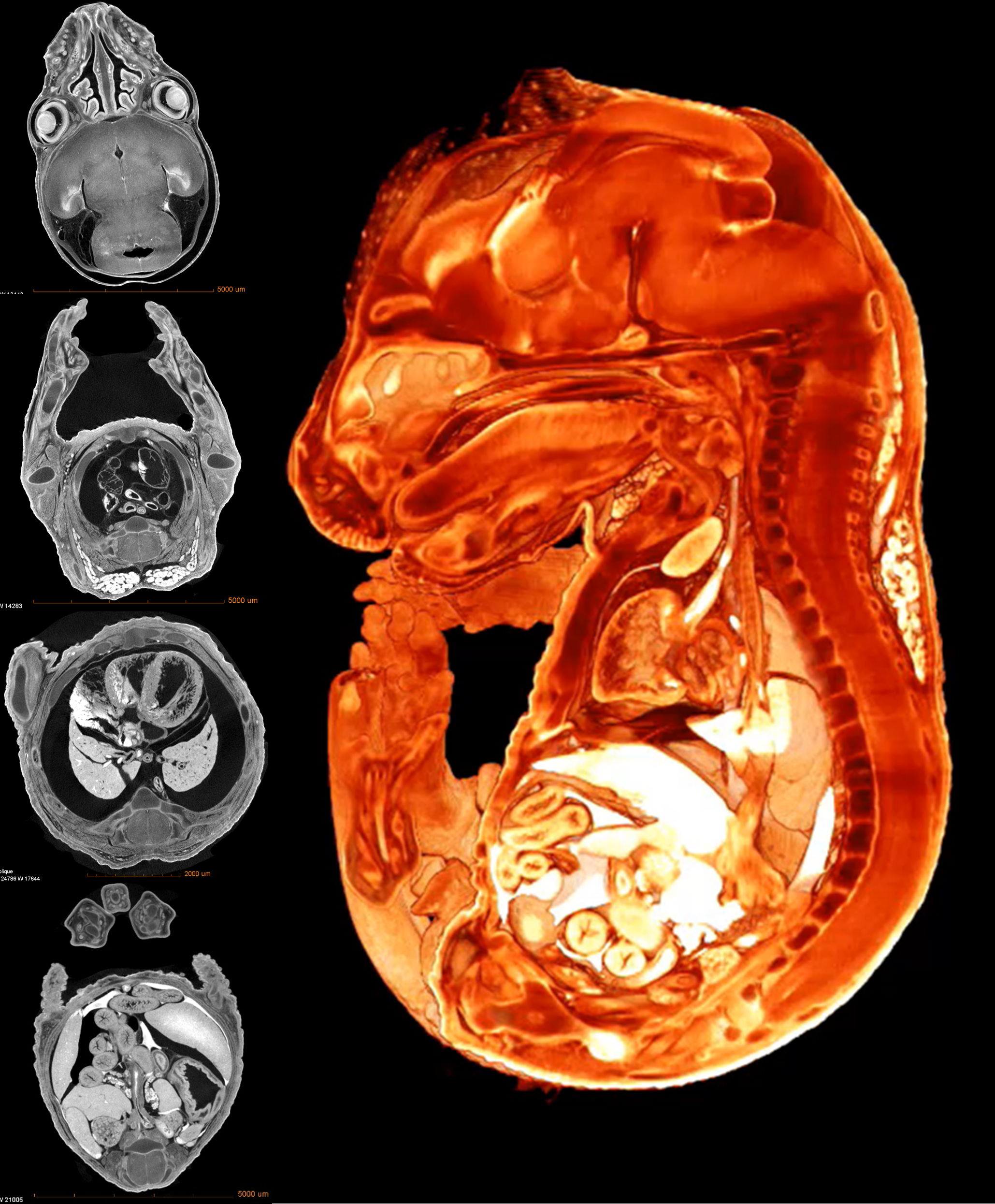 ZEISS Microscopy for Developmental Biology