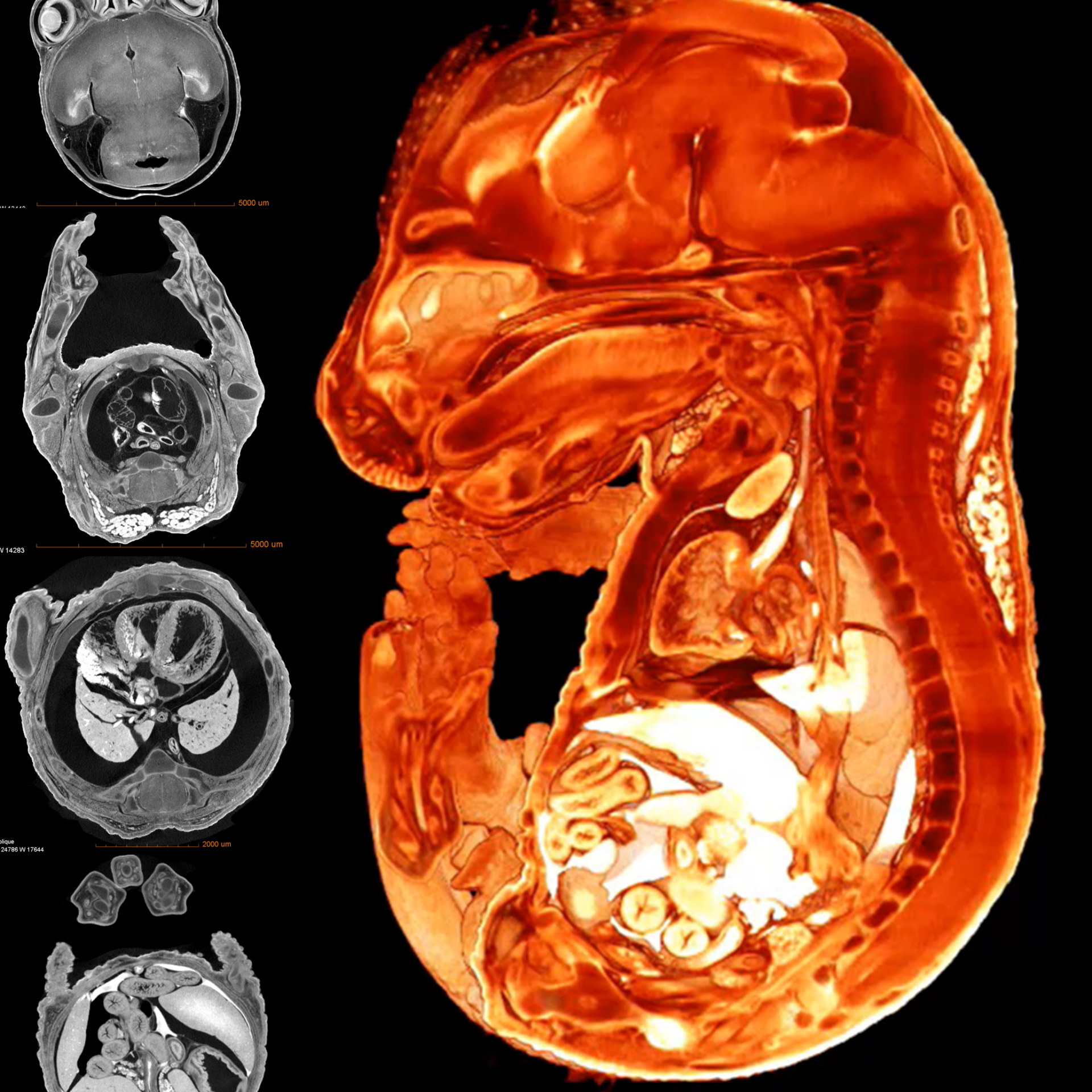 Developmental Biology