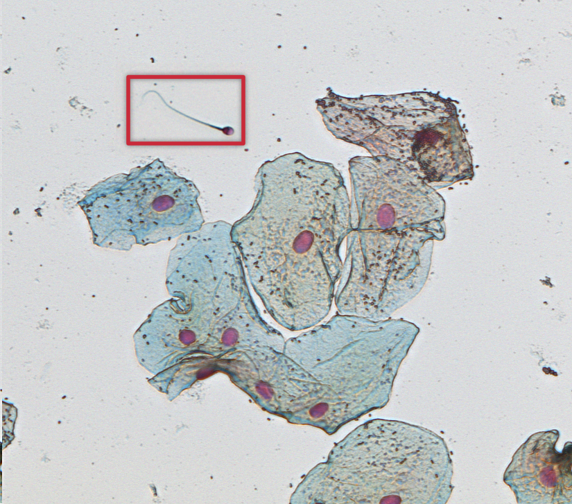 Forensic
