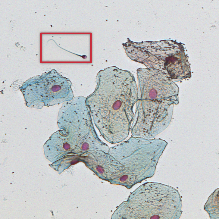 Forensic