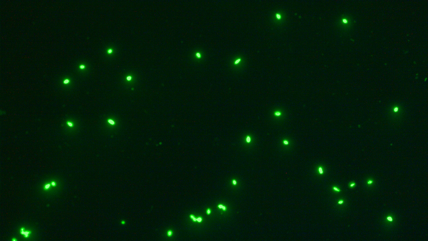 Sample 1, staining of sperm with HY-Liter, green fluorescence, Alexa, acquired with Axio Scope.A1, objective: 40x, forensics