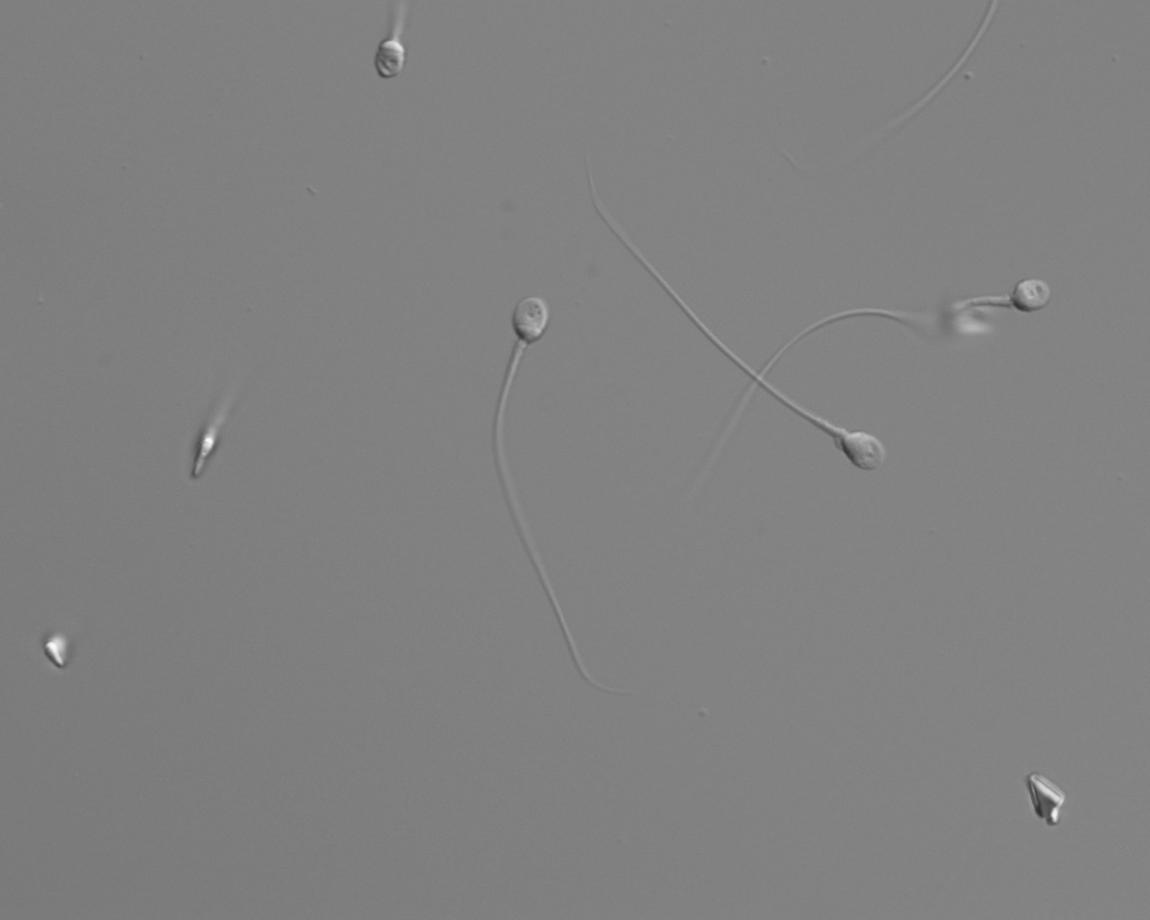 In Vitro Fertilization