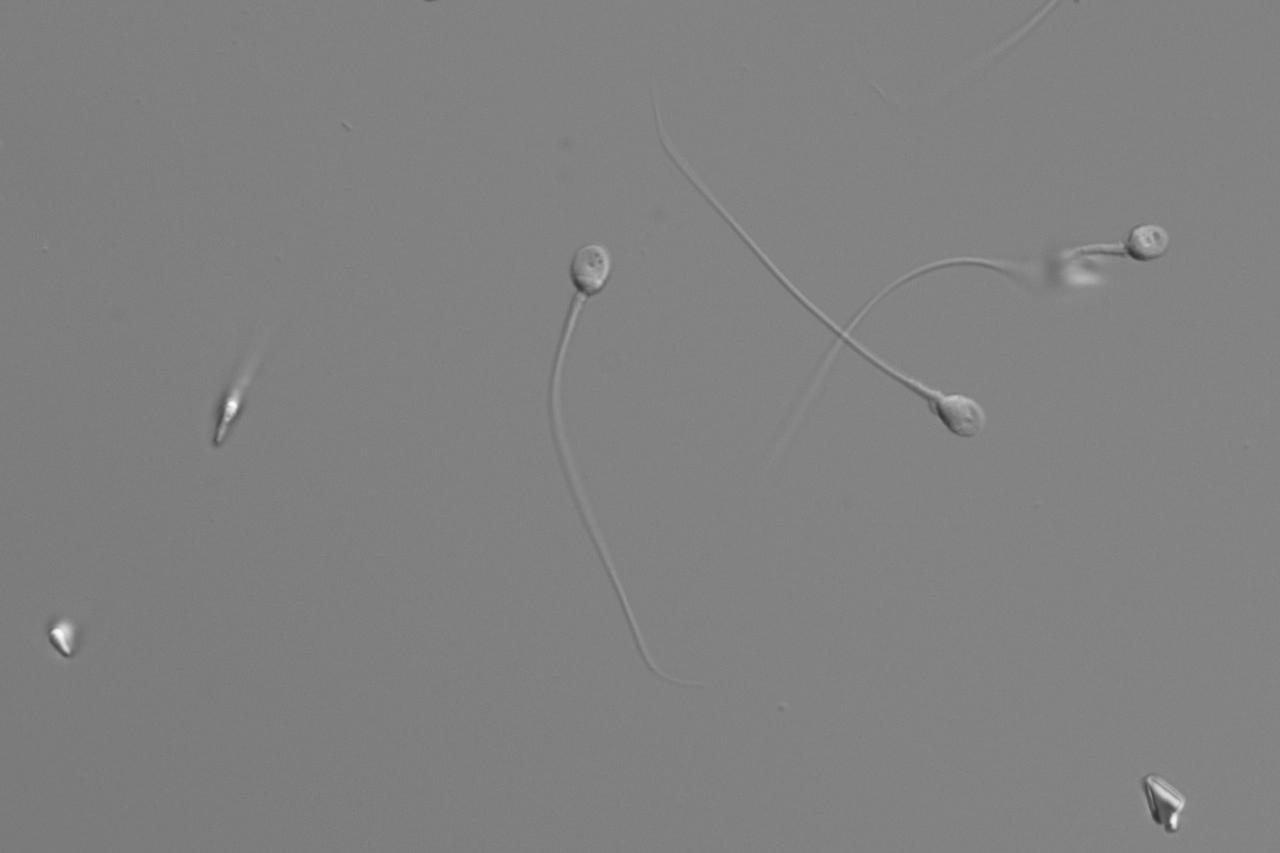 In Vitro Fertilization