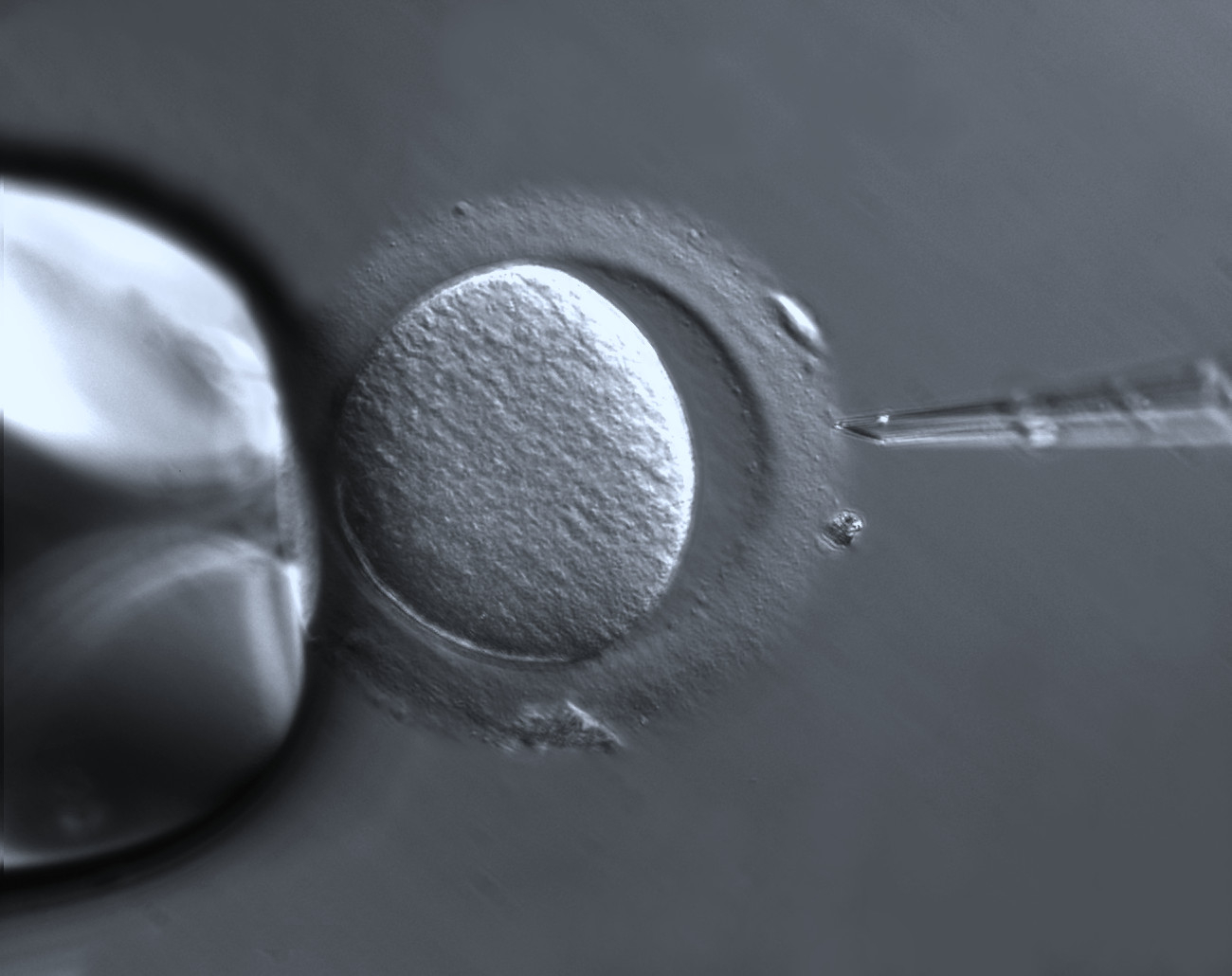 In Vitro Fertilization