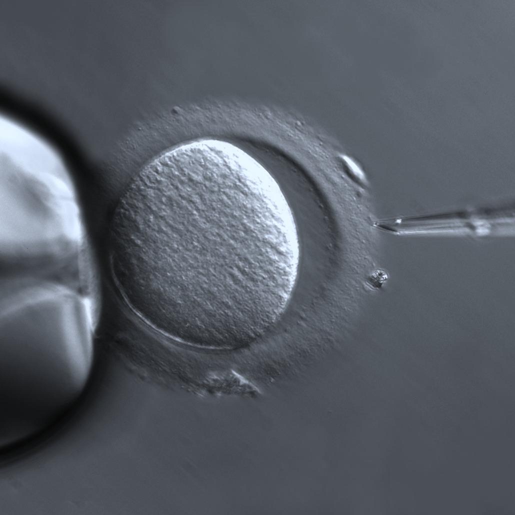In Vitro Fertilization