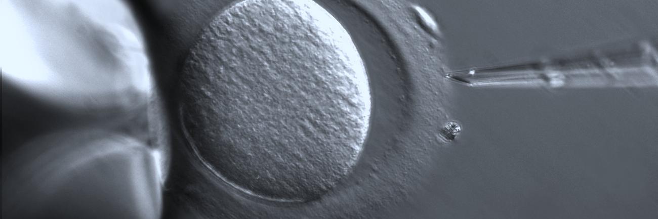 In Vitro Fertilization
