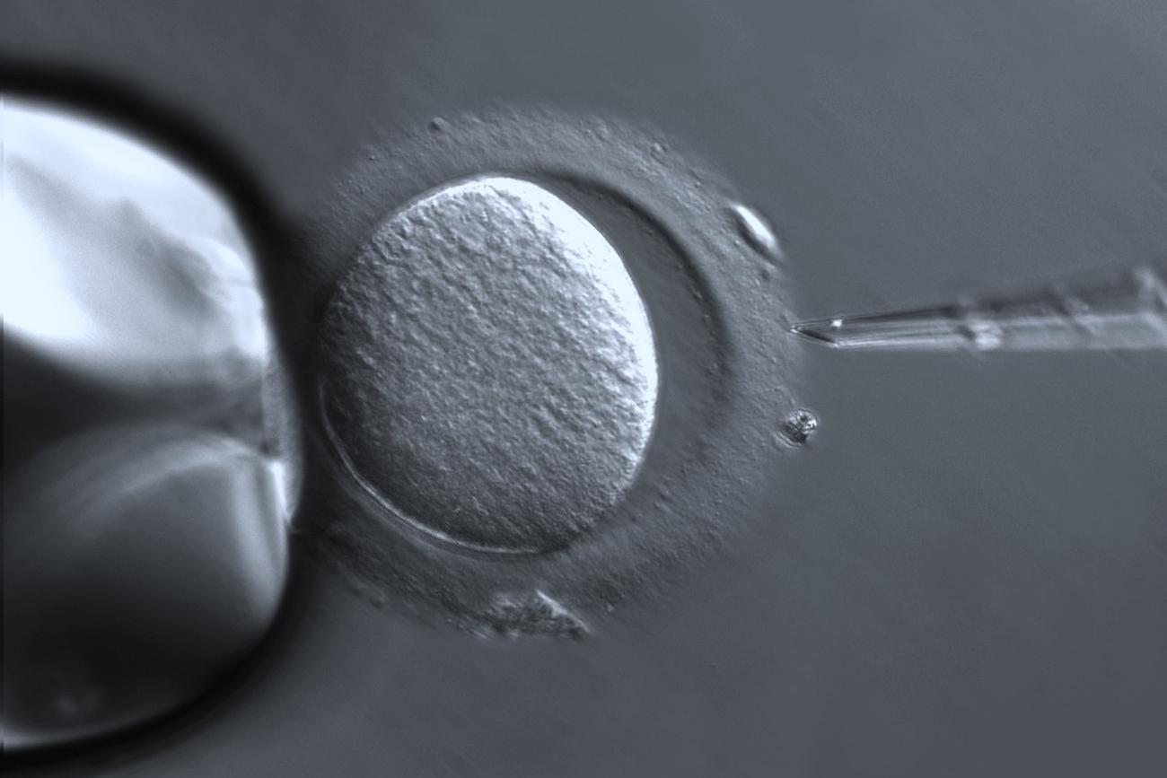 In Vitro Fertilization