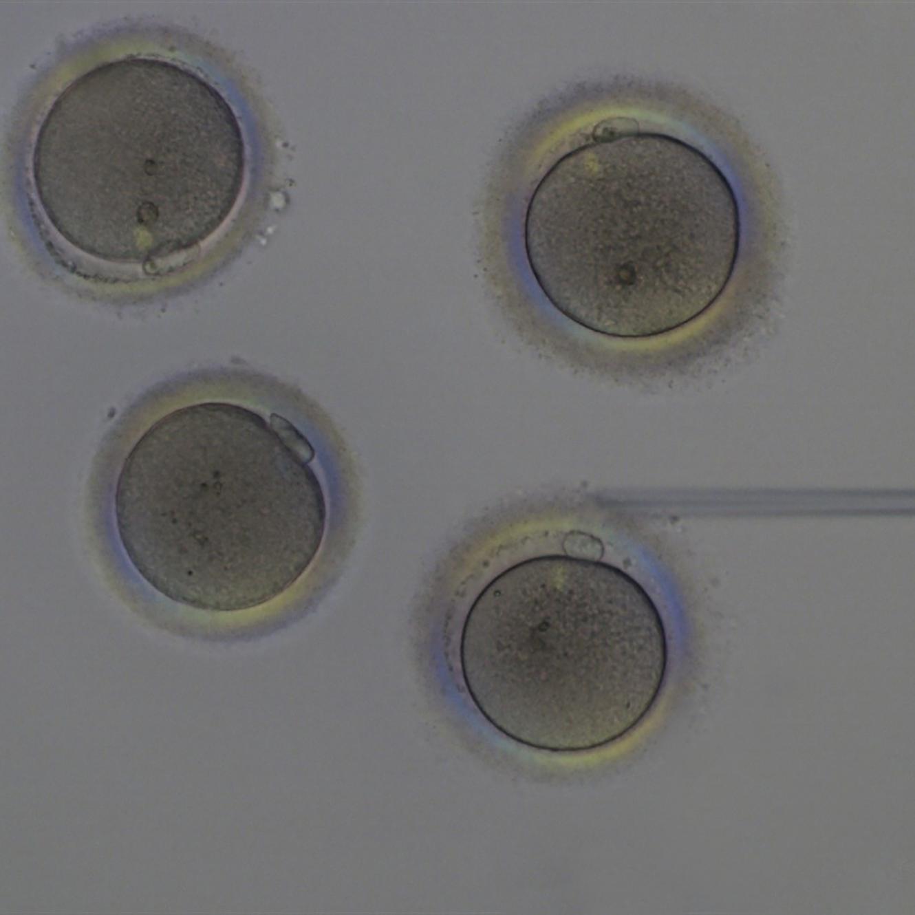 In Vitro Fertilization