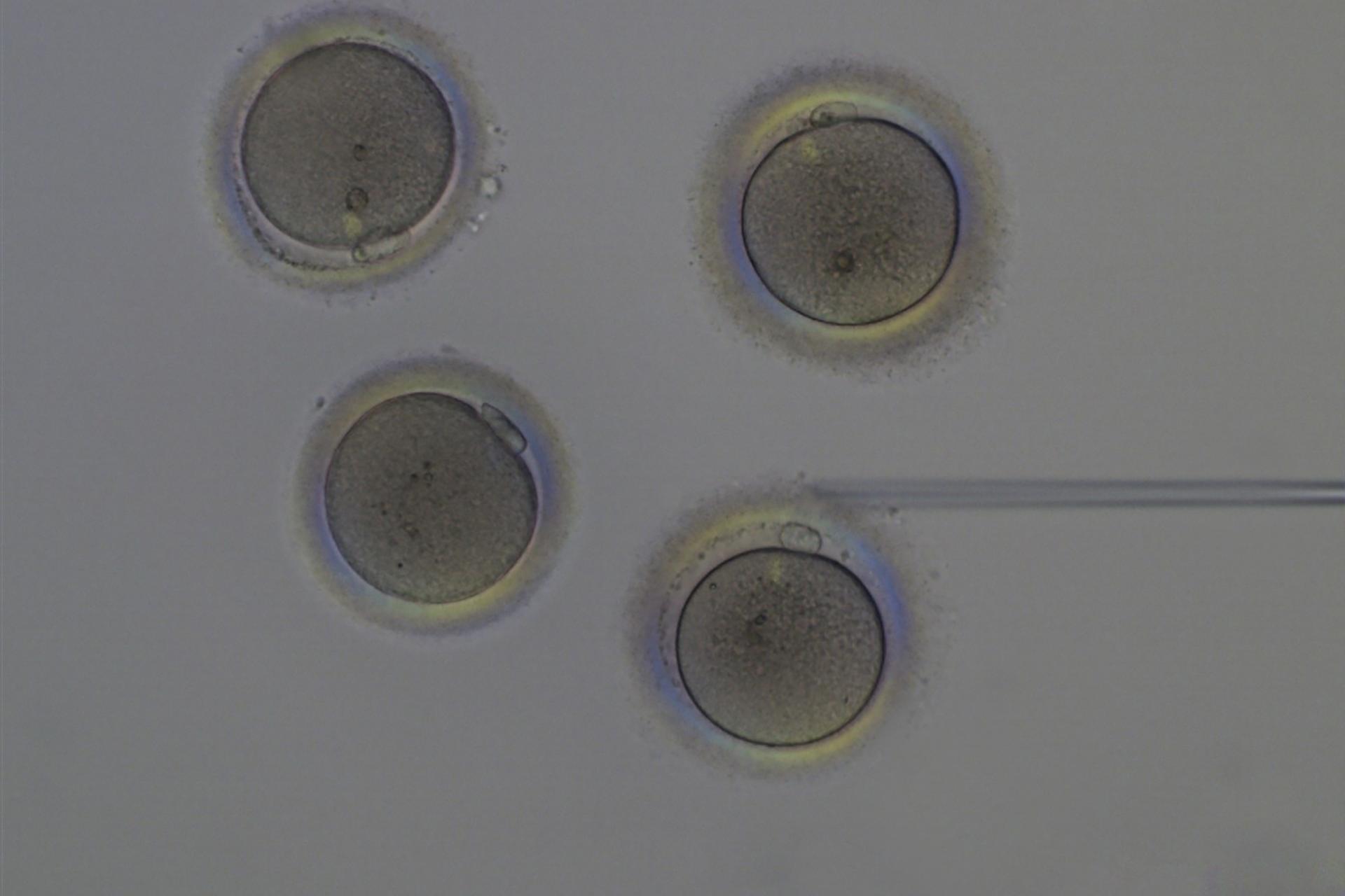 In Vitro Fertilization