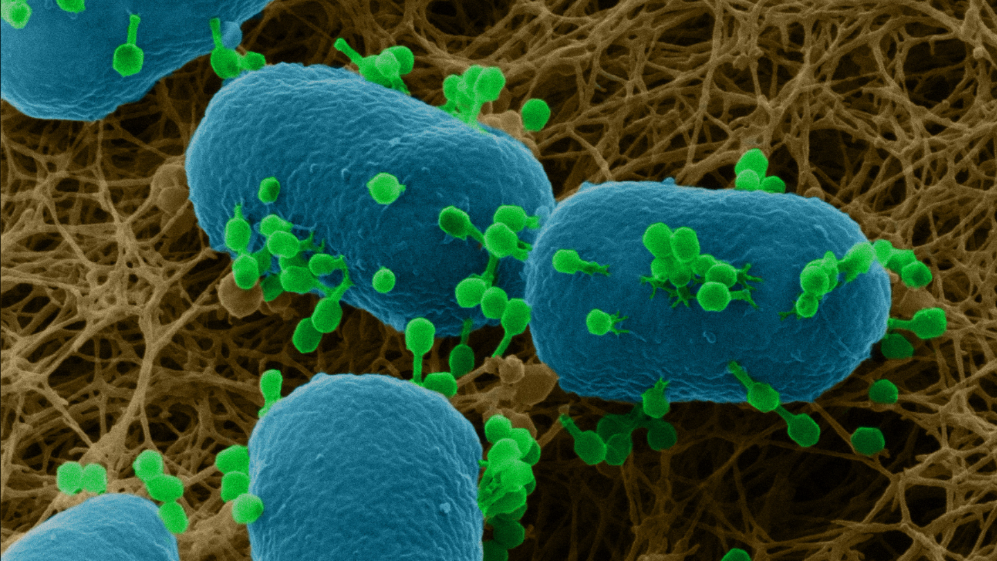 Possibility to image the uncoated biological samples with sub-nanometer resolution is the unique thing when using NanoFab system. Study with this system offers great insights to interactions of the viruses with bacteria as it happens on the bacteria plate.
