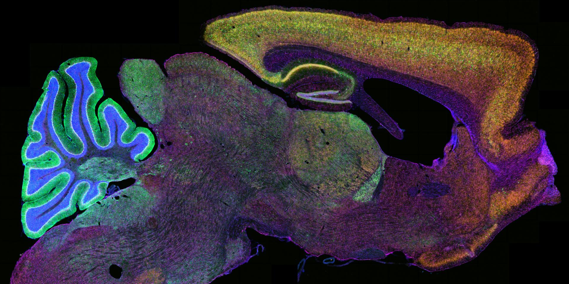 Adult mouse brain 25um sagittal cryosections, stained free floating using Neuromabs