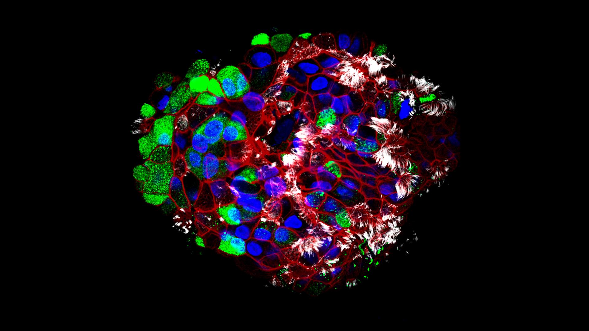 Human Distal Lung Organoid showing club cells and ciliated cells