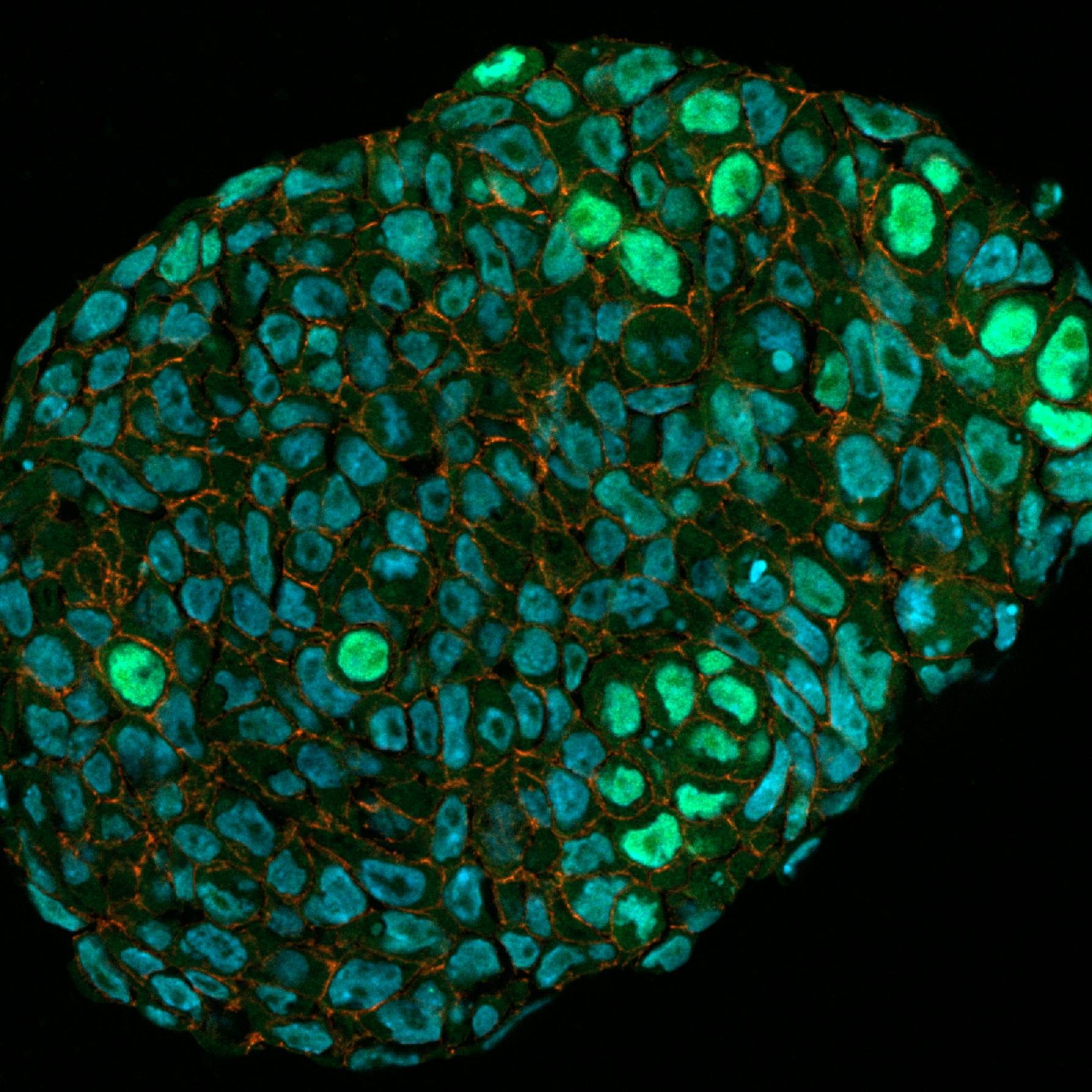 Organoids