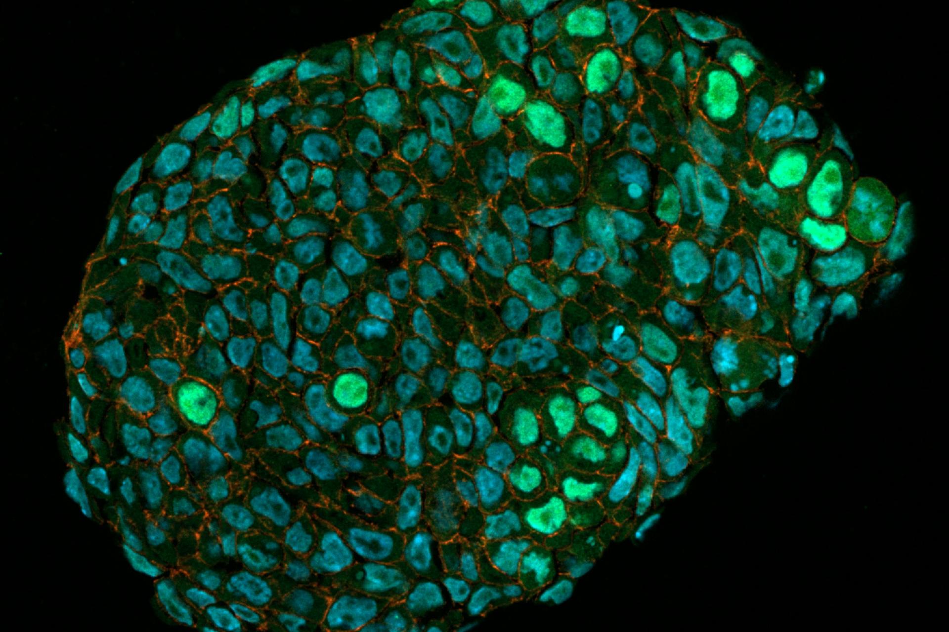 Organoids