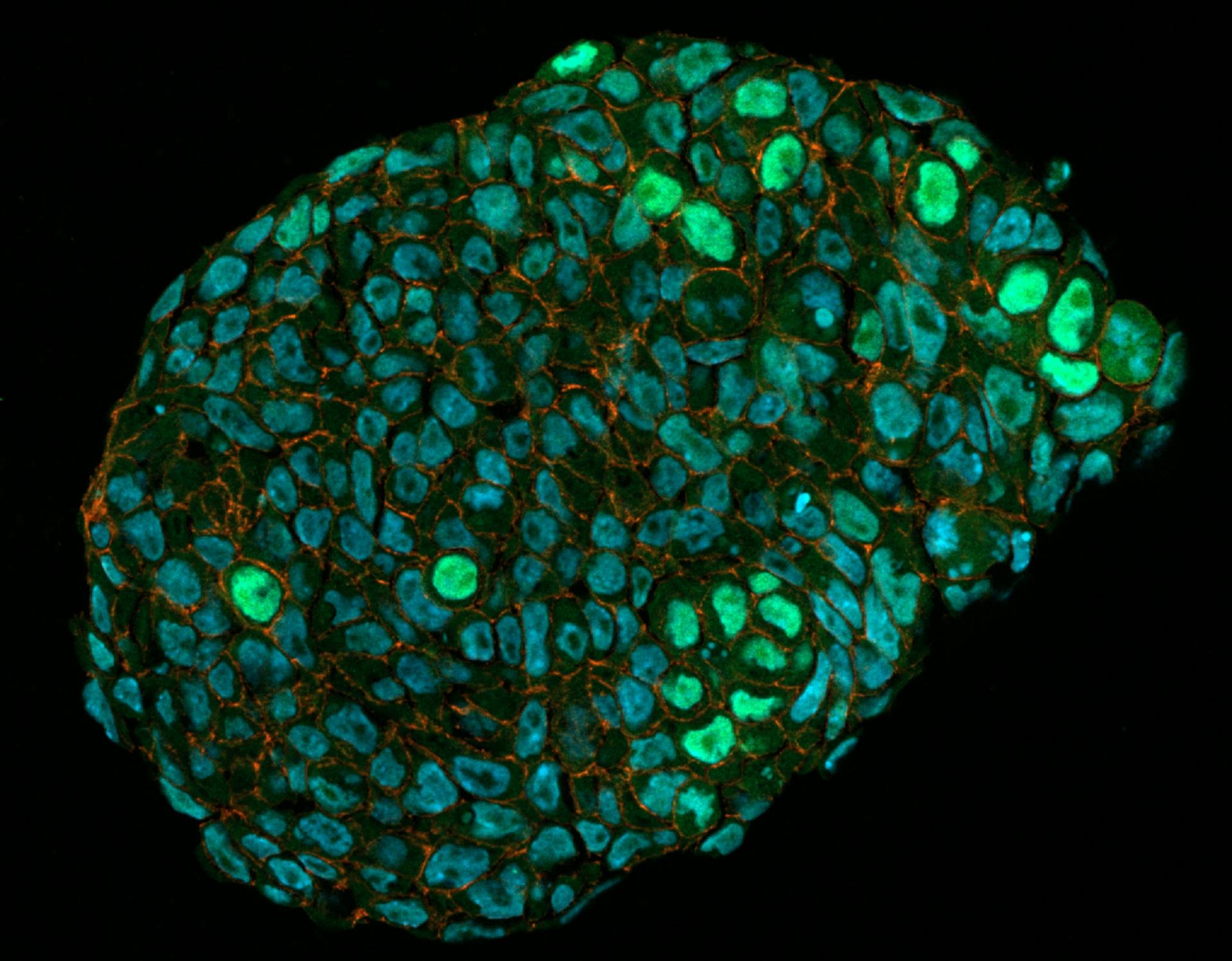 Organoids