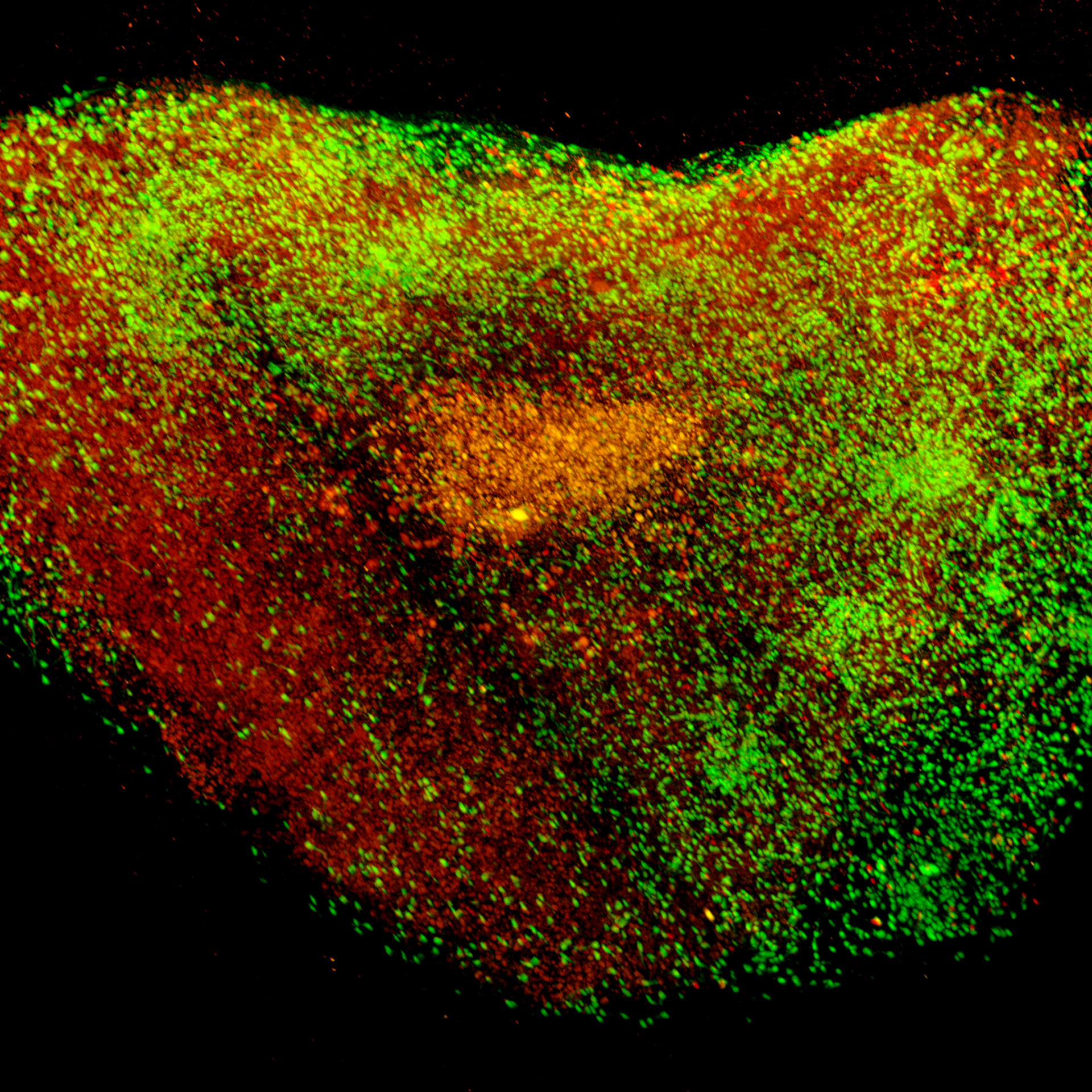 Organoids