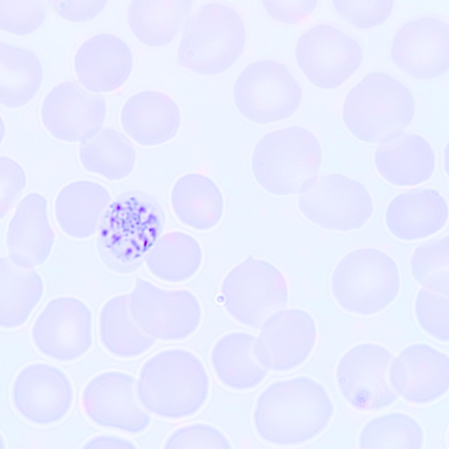 Pathology